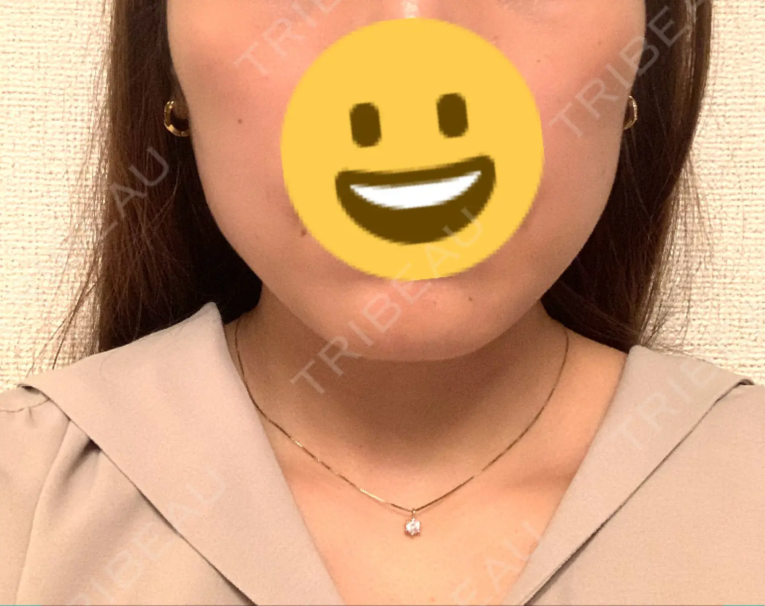 施術前の写真