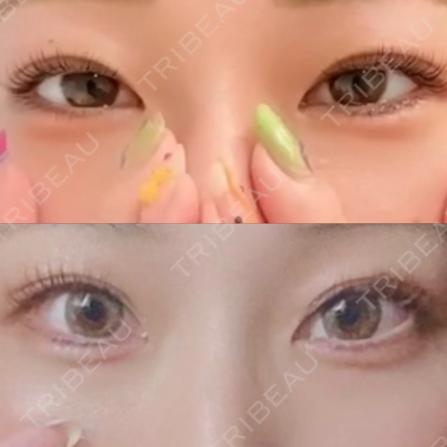施術前の写真