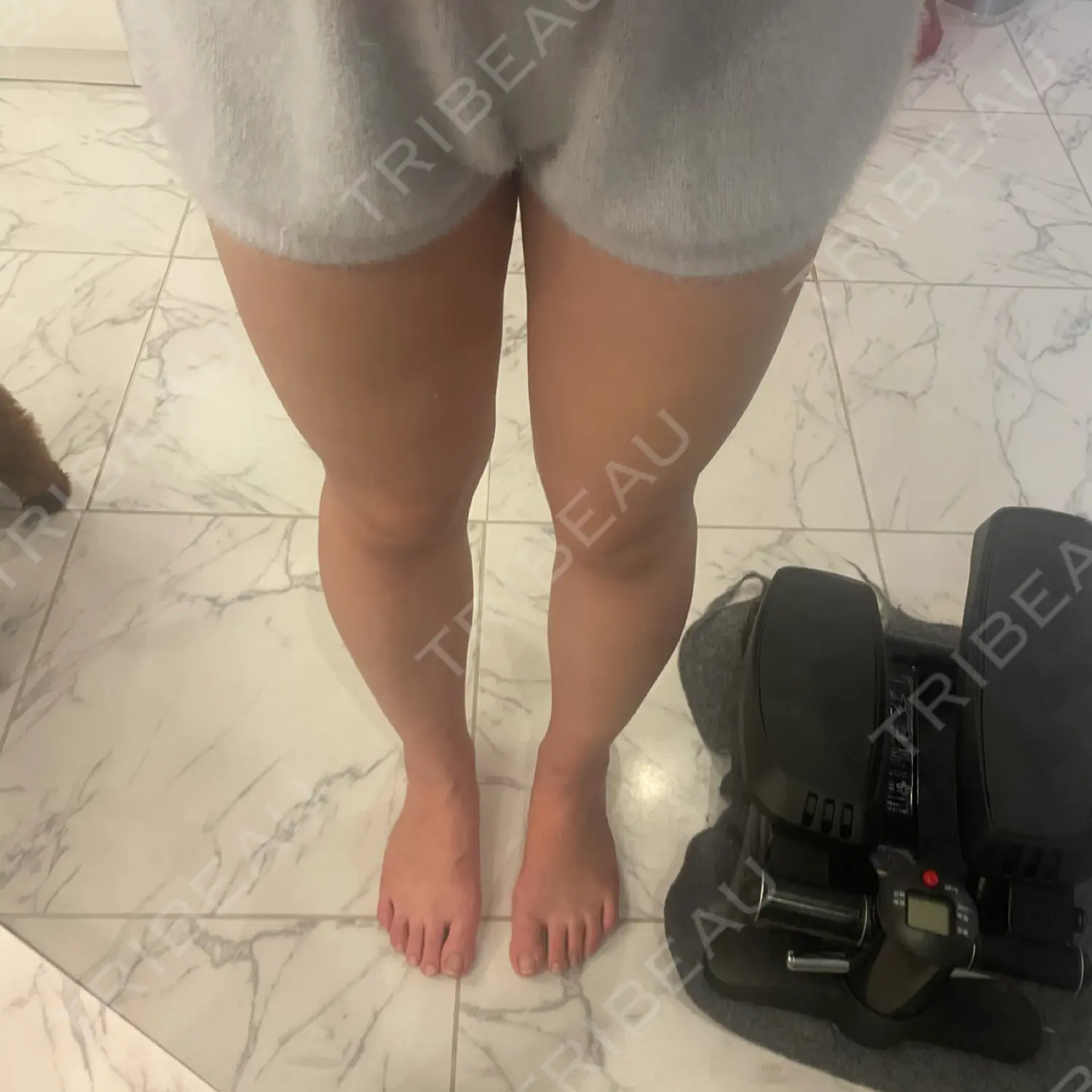 施術前の写真