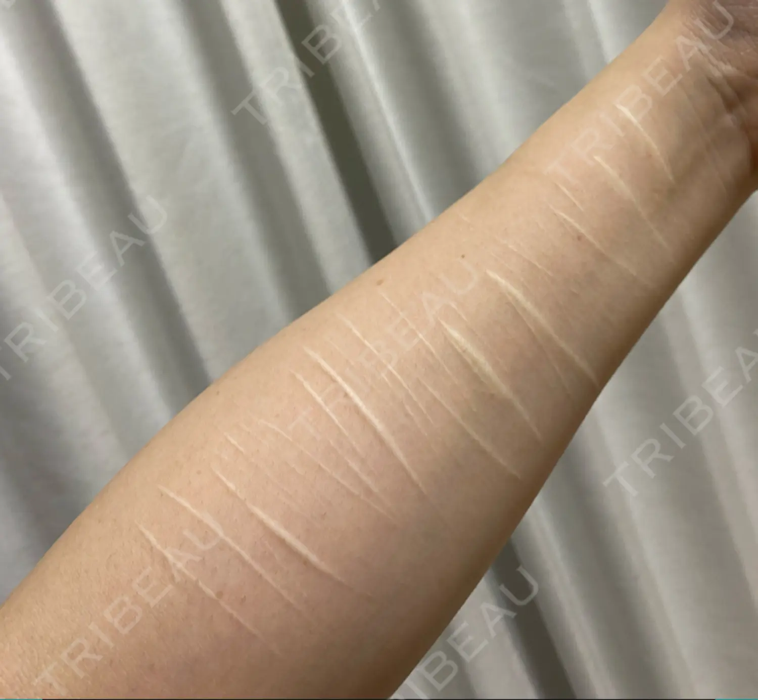 施術前の写真