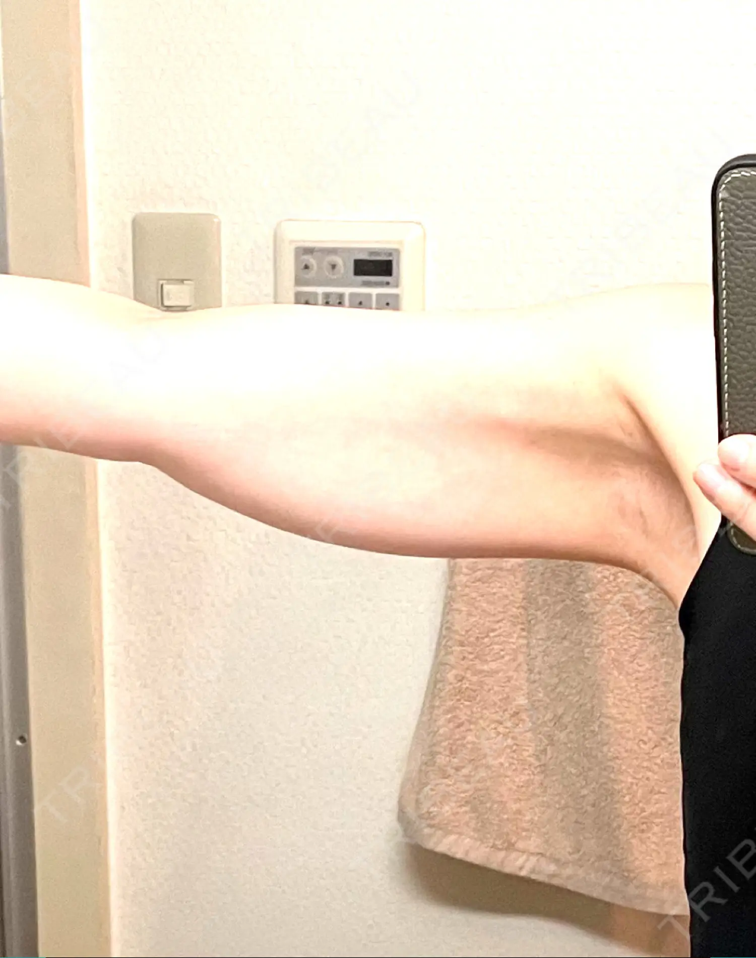 施術前の写真