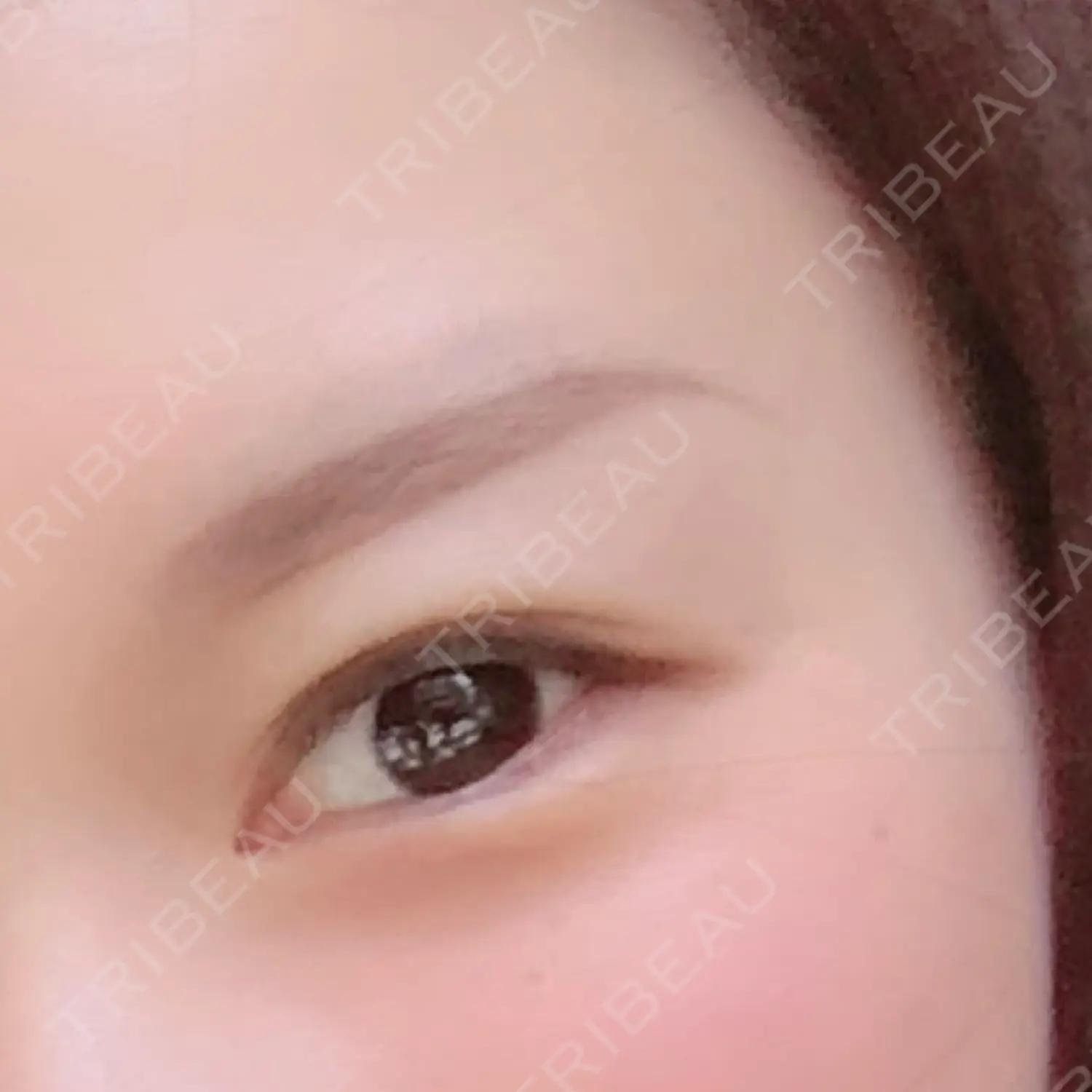 施術前の写真
