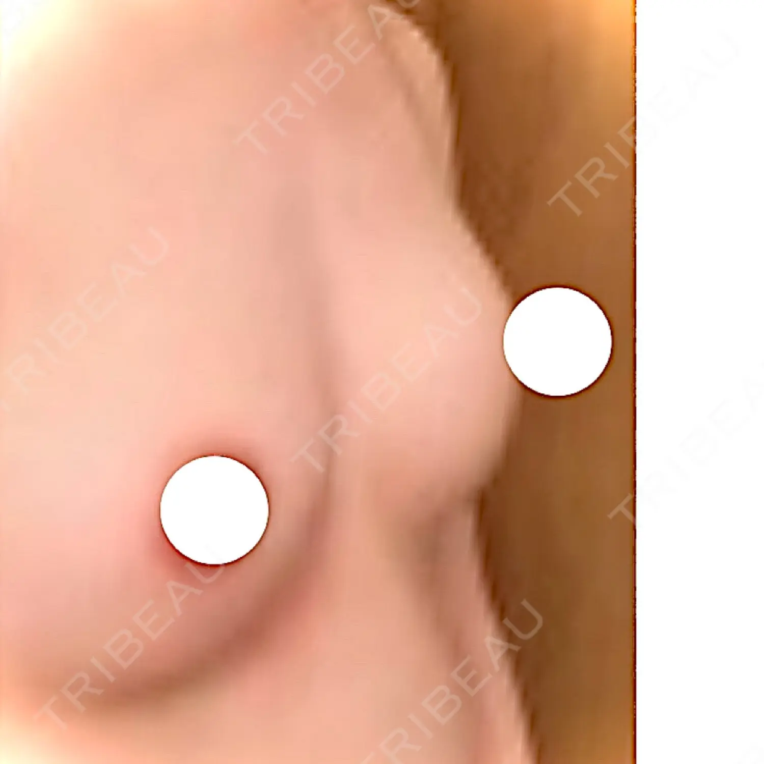 施術前の写真