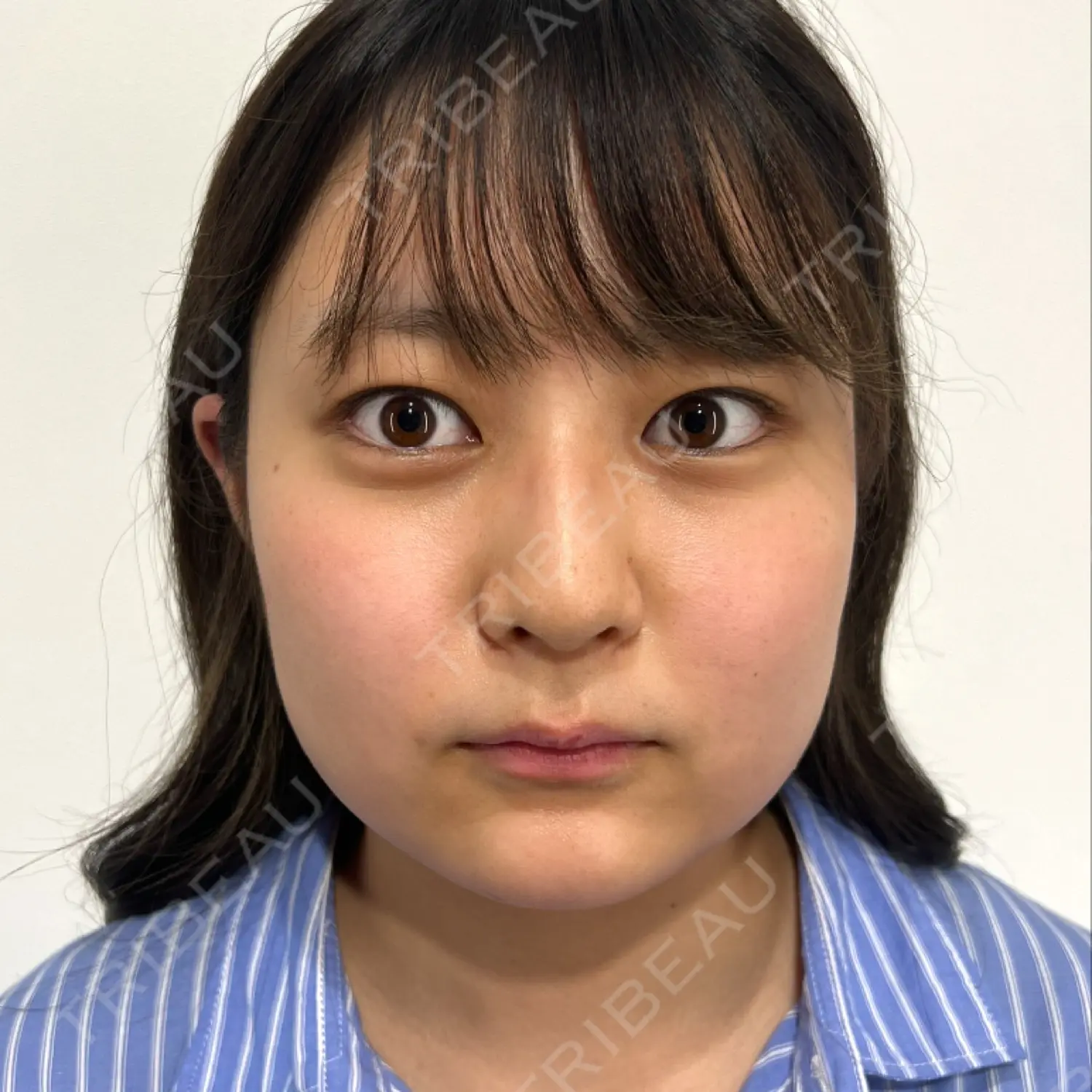 施術前の写真