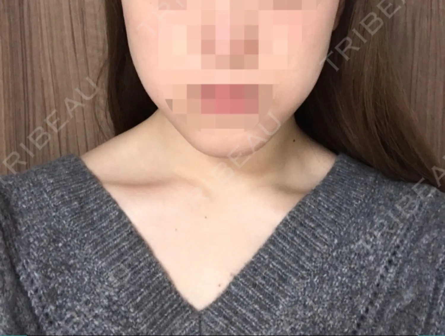 施術前の写真