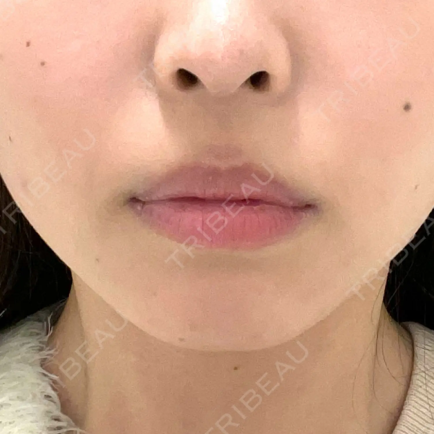 施術前の写真