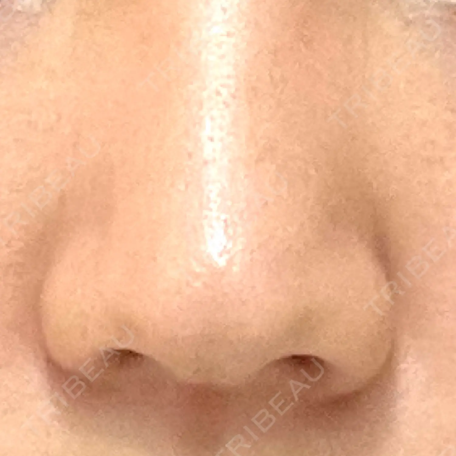 施術前の写真