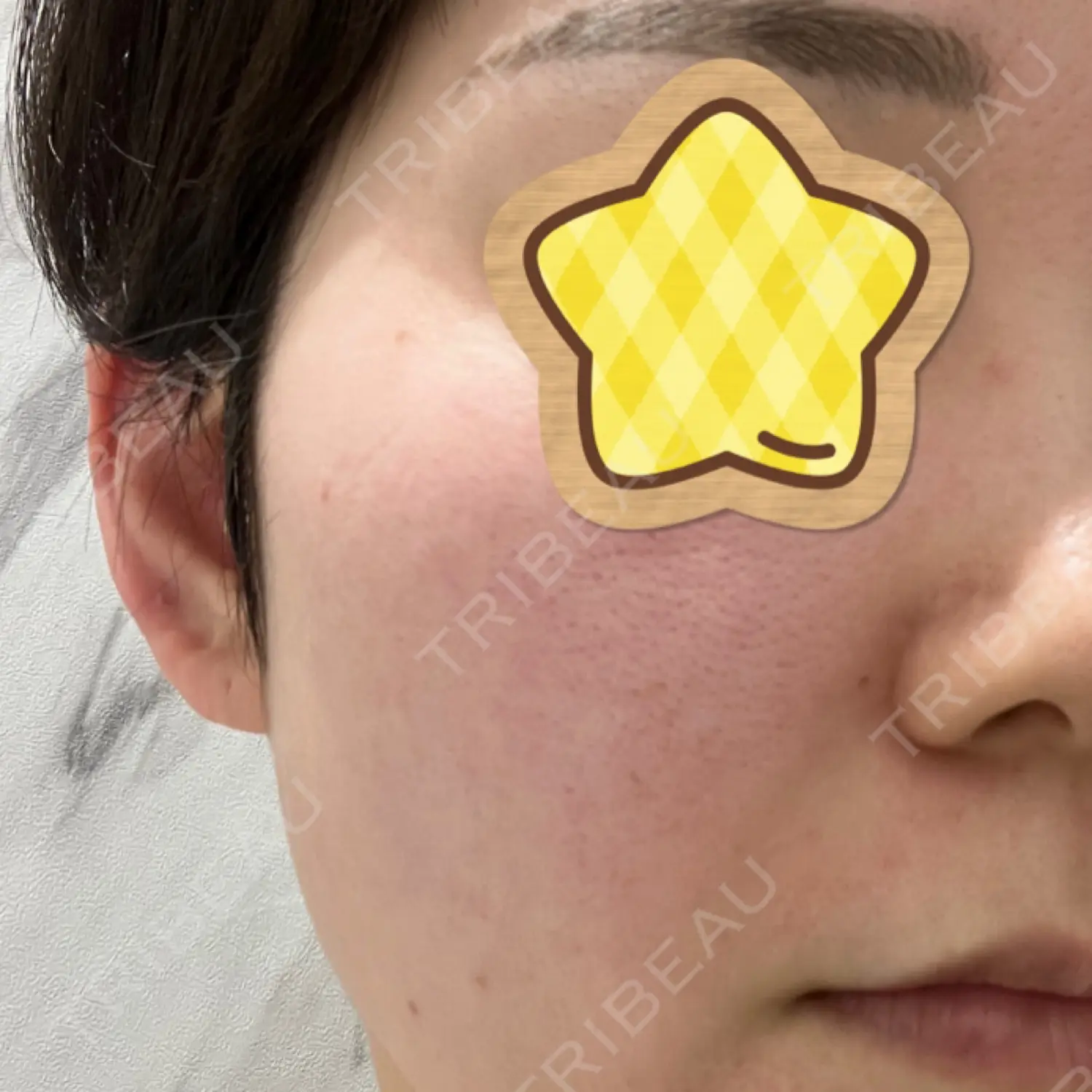 施術前の写真