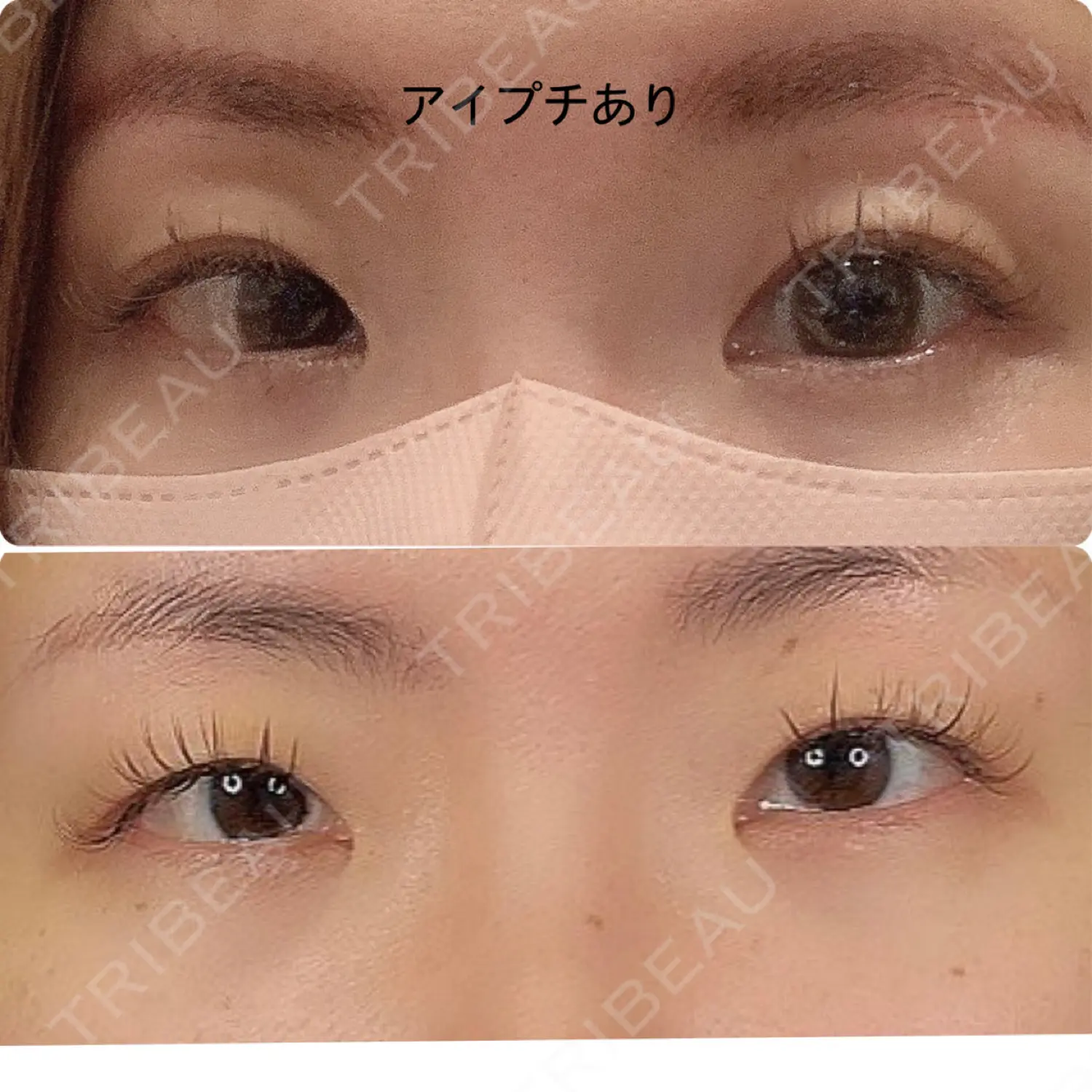 施術前の写真