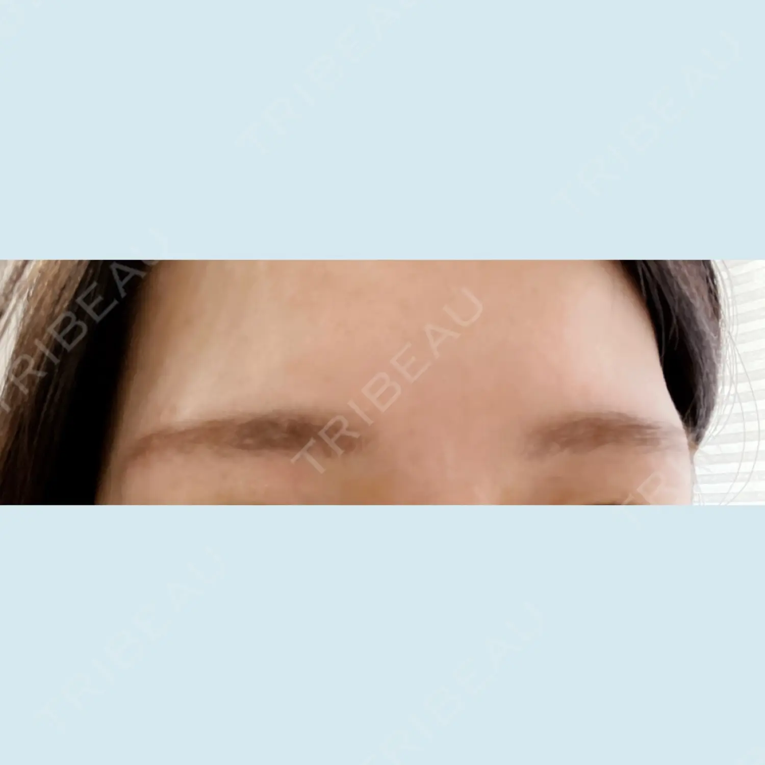 施術前の写真