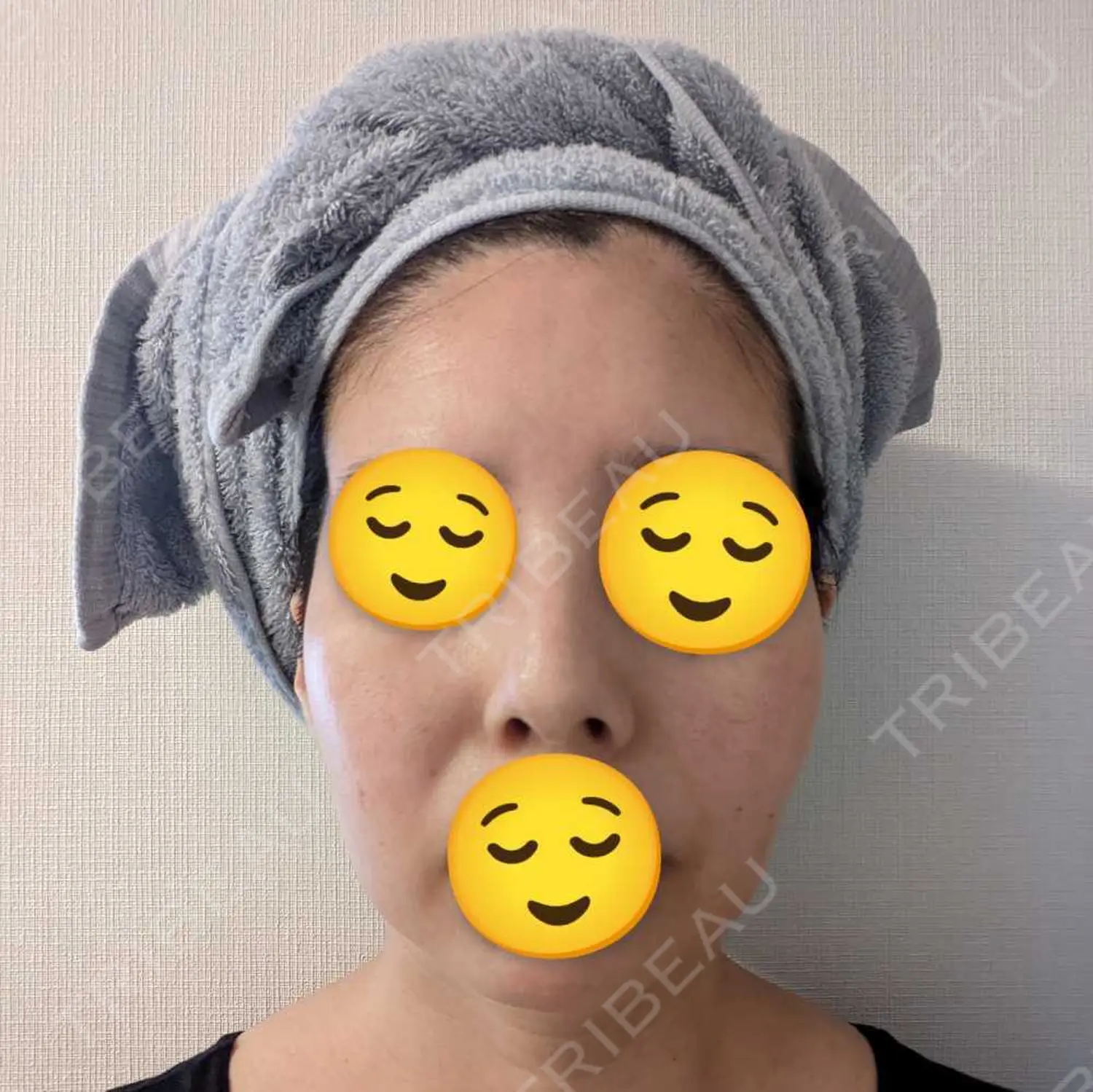 施術前の写真