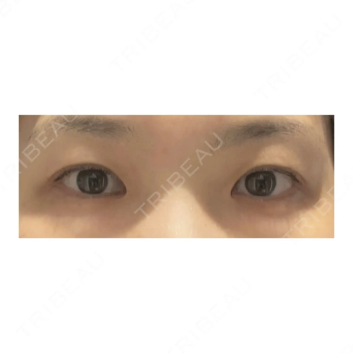 施術前の写真