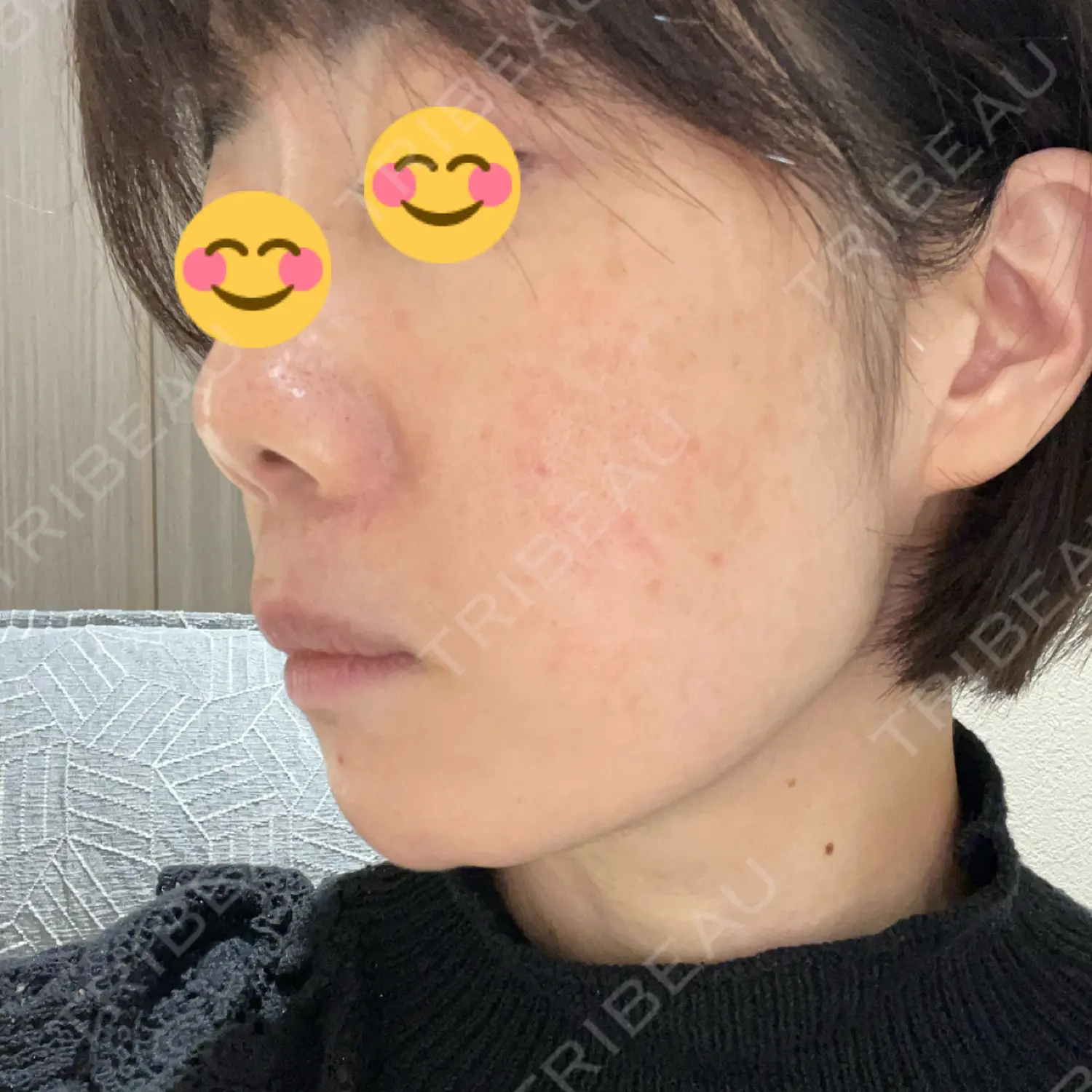 施術前の写真