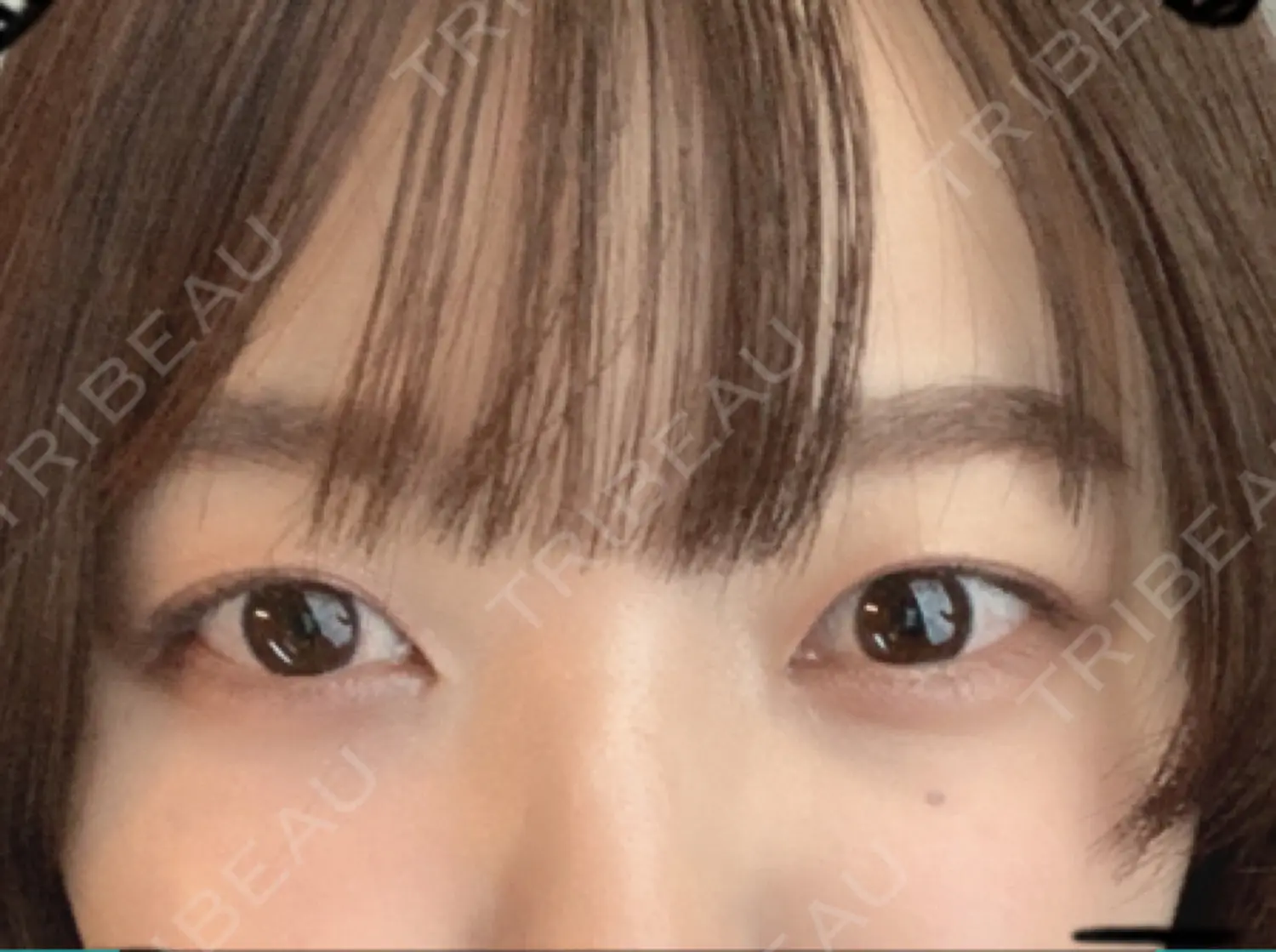 施術前の写真