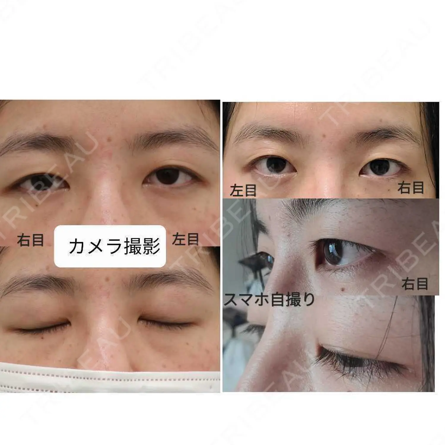 施術前の写真