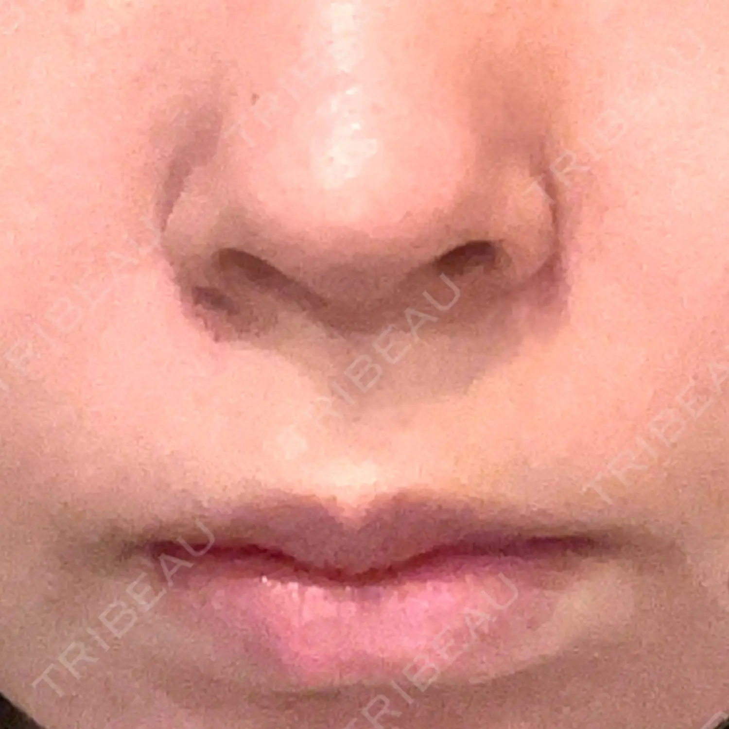 施術前の写真