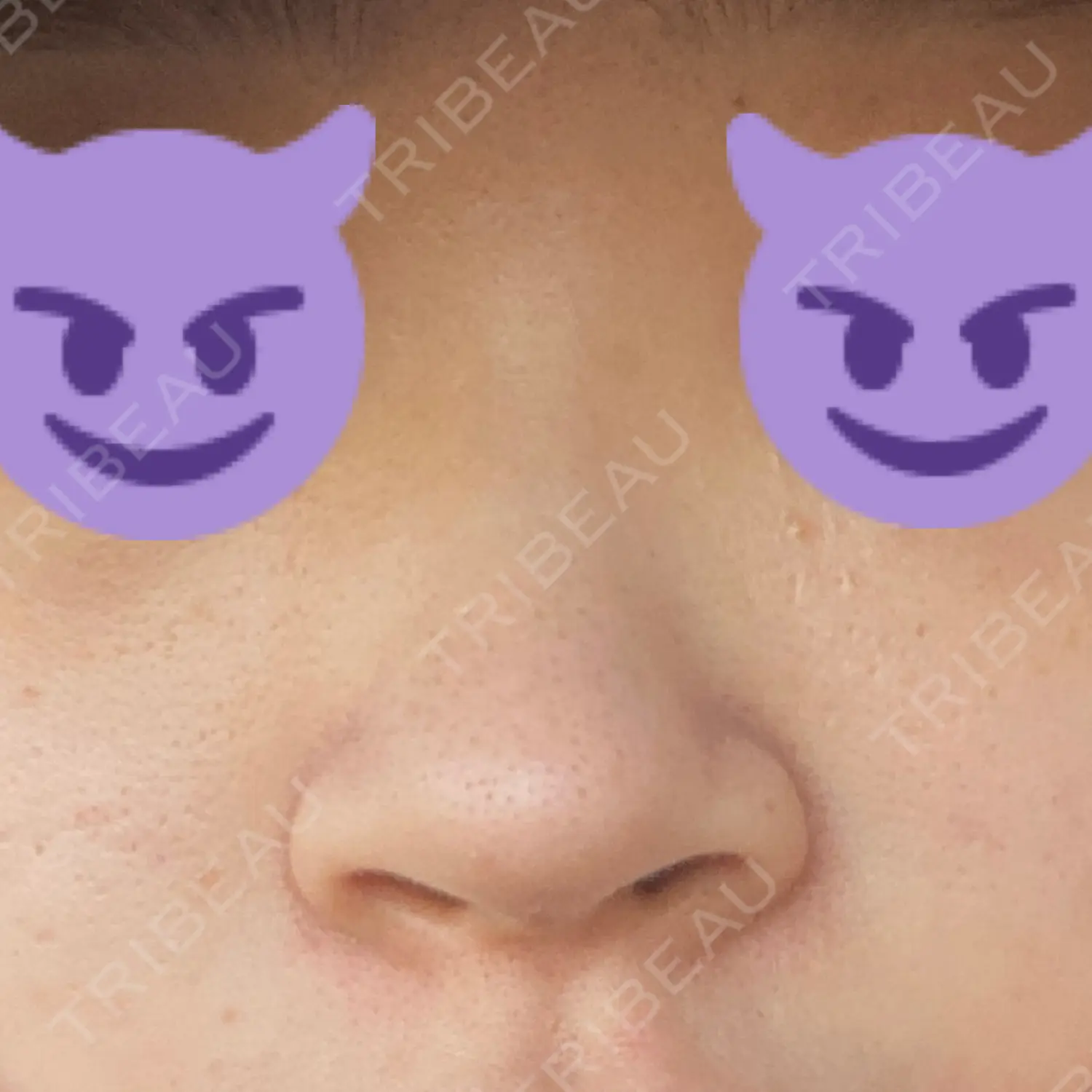 施術前の写真