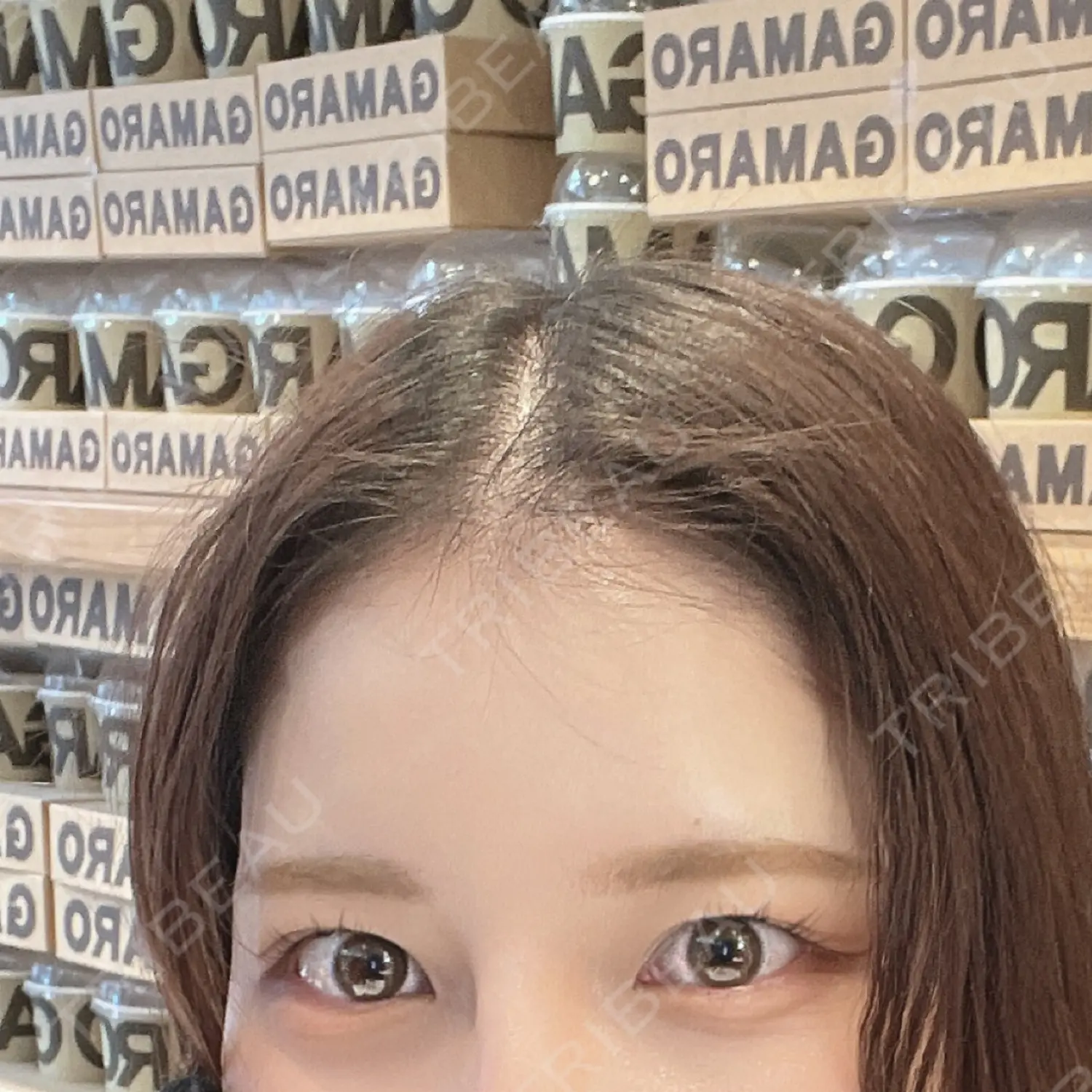 施術前の写真