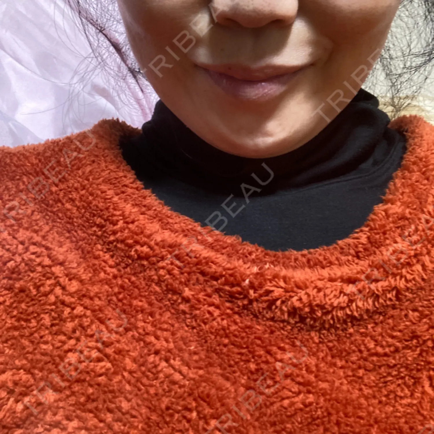 施術前の写真
