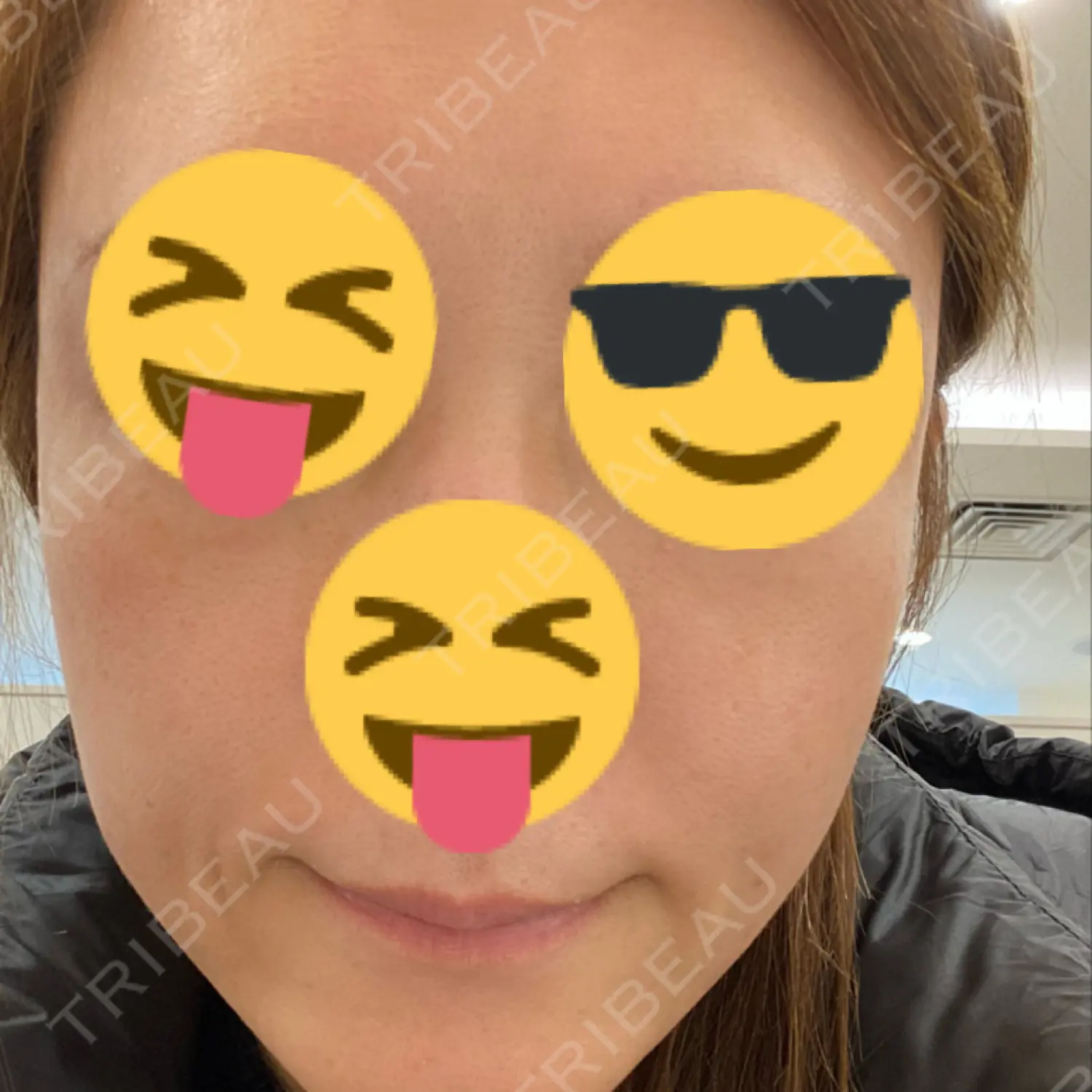 施術前の写真