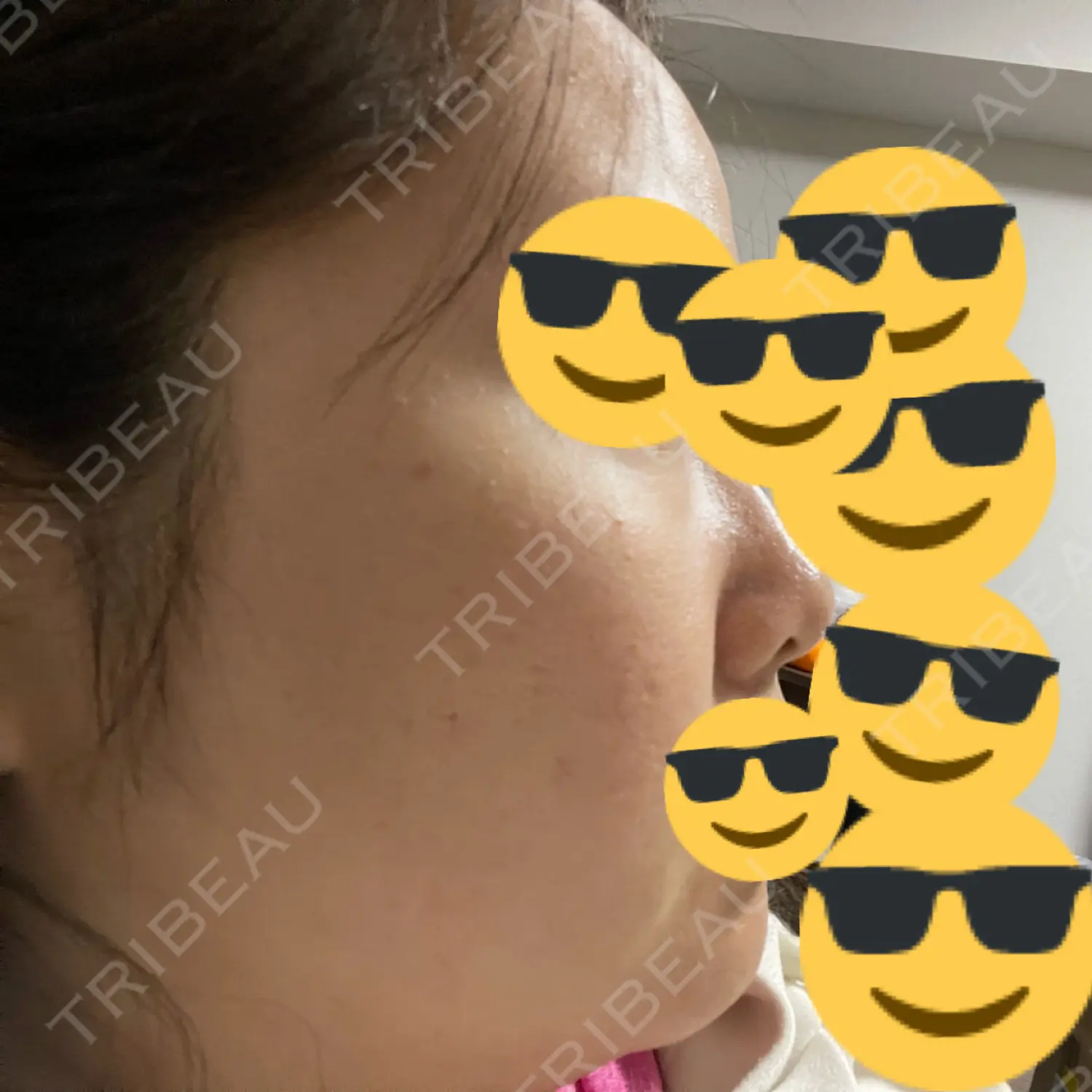 施術前の写真