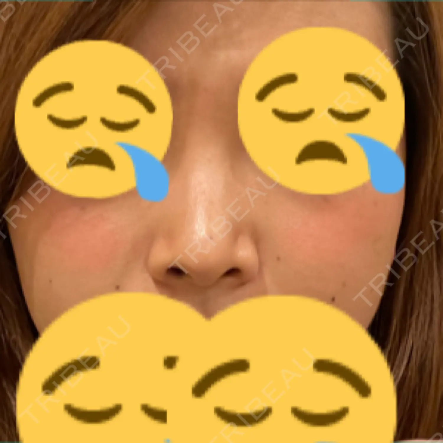 施術前の写真