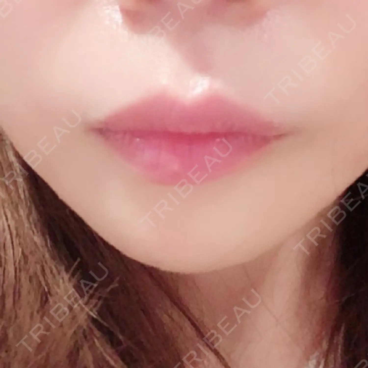 施術前の写真