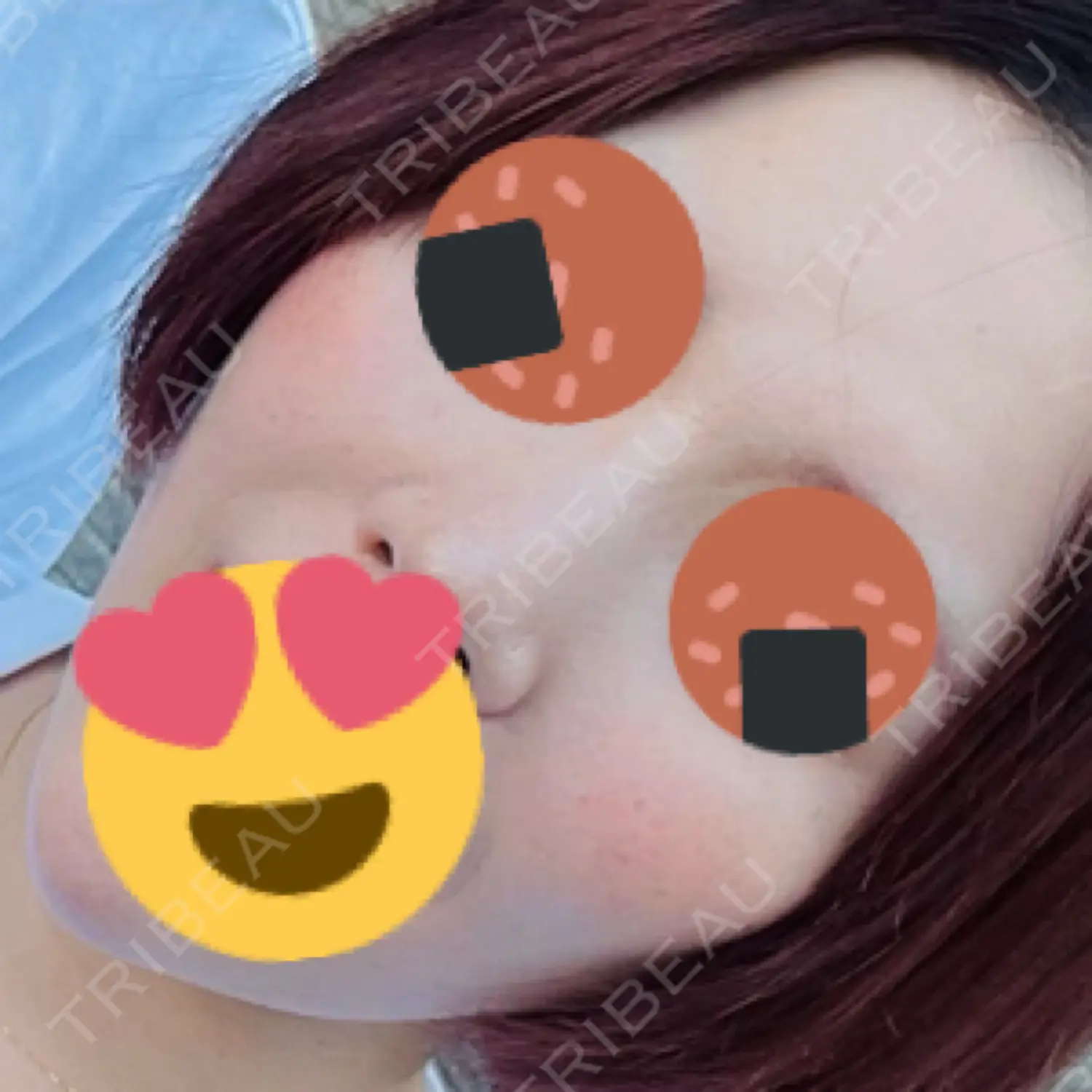 施術前の写真