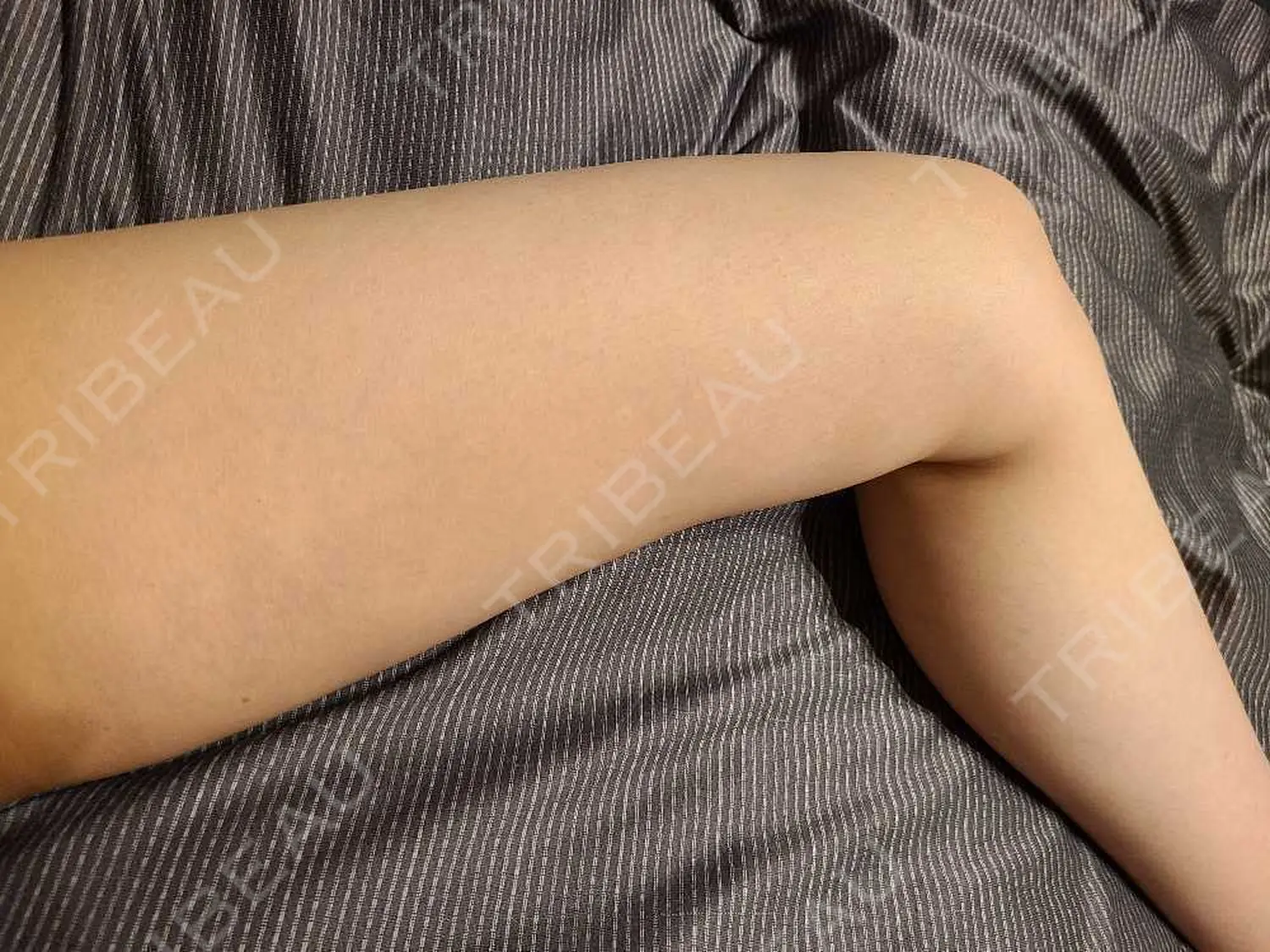 施術前の写真