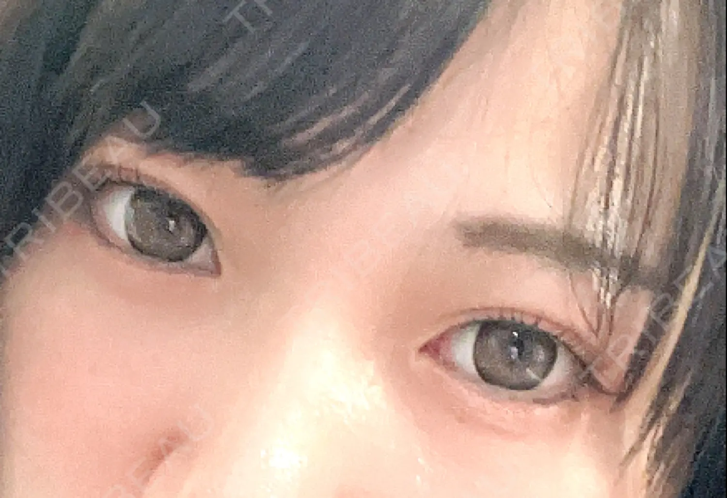 施術前の写真