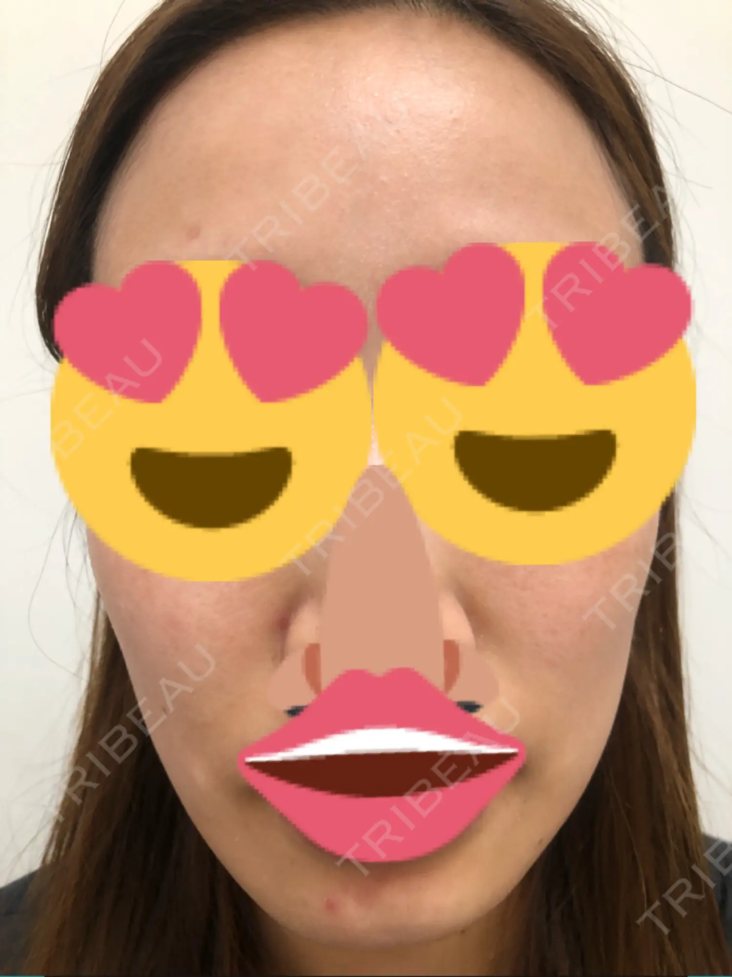 施術前の写真