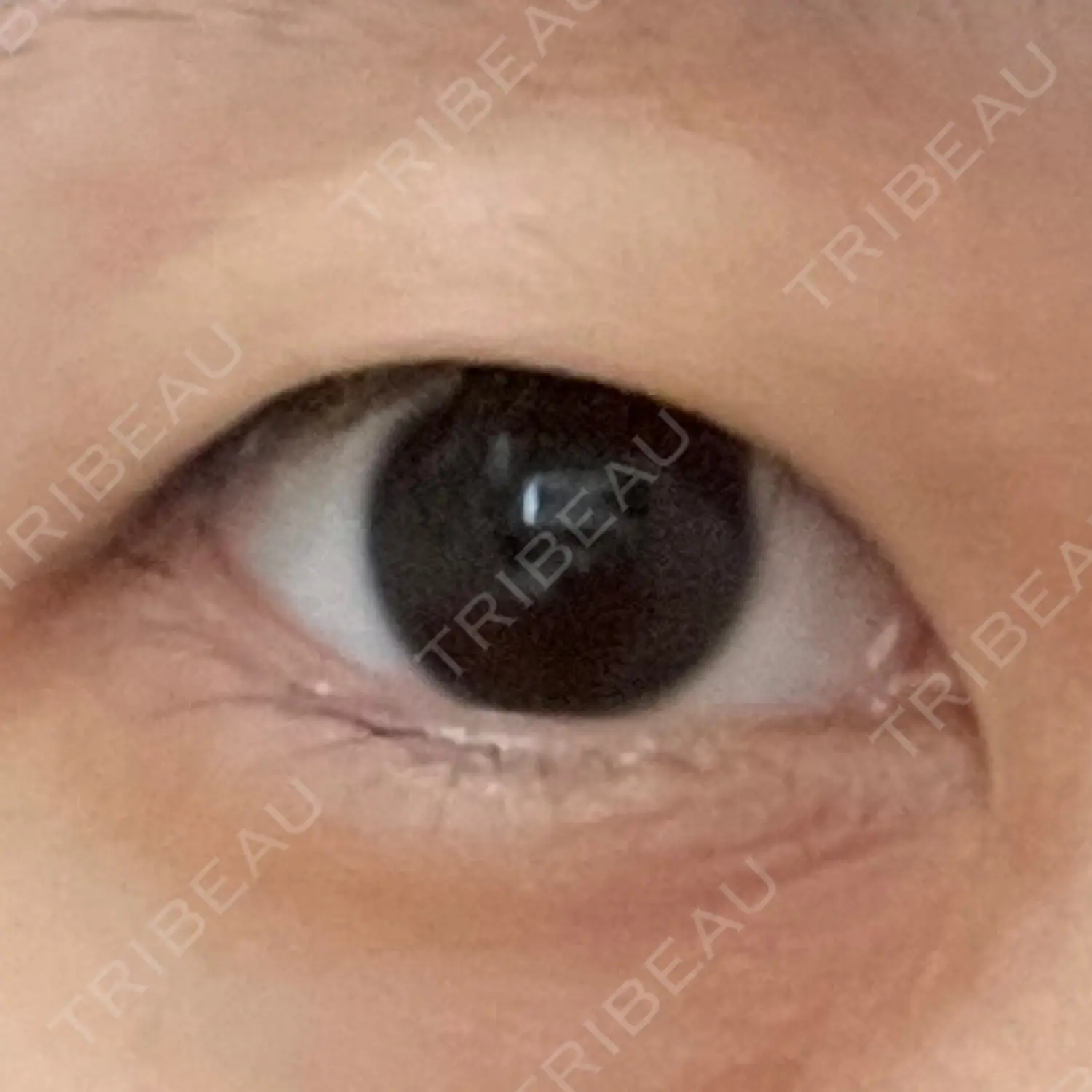 施術前の写真