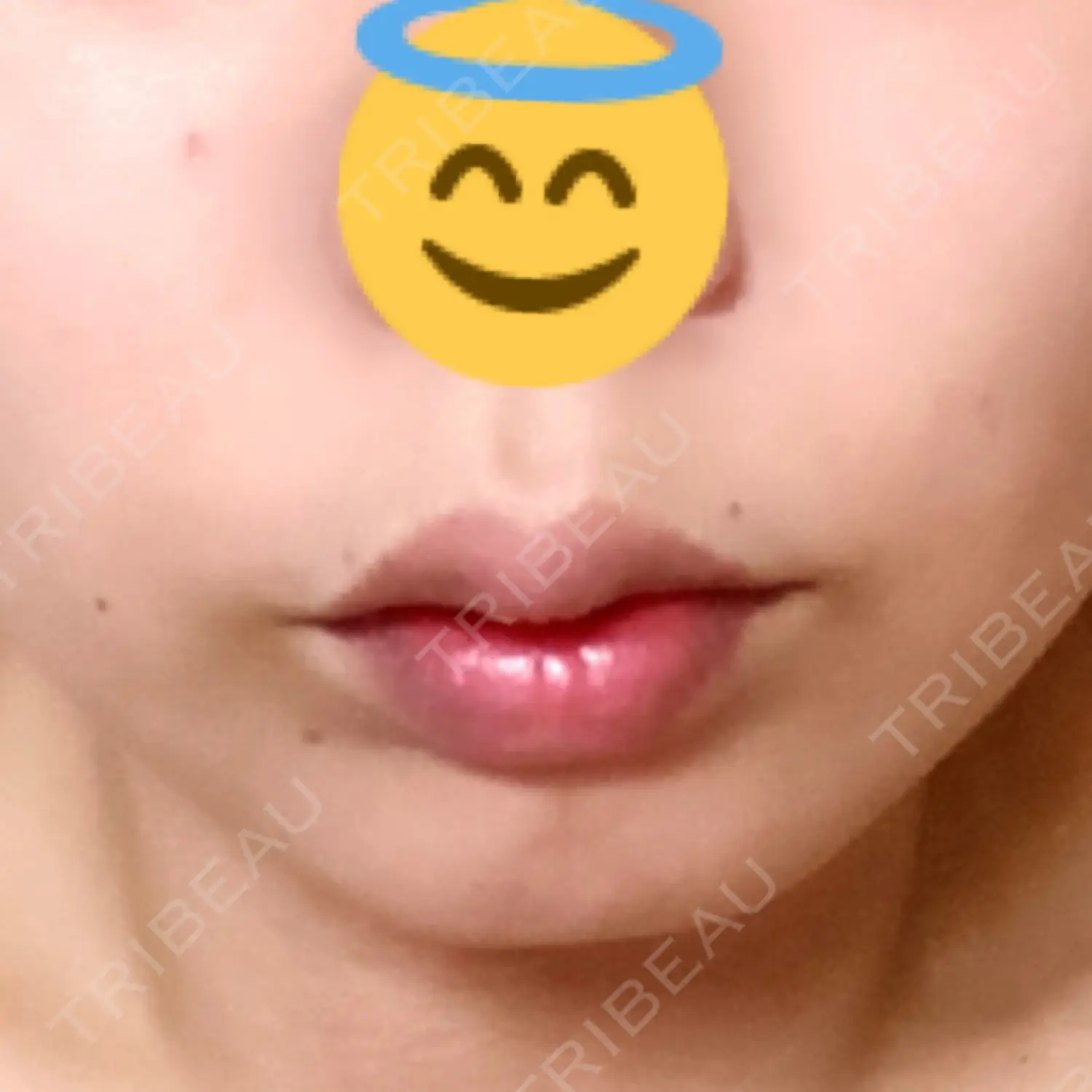 施術前の写真
