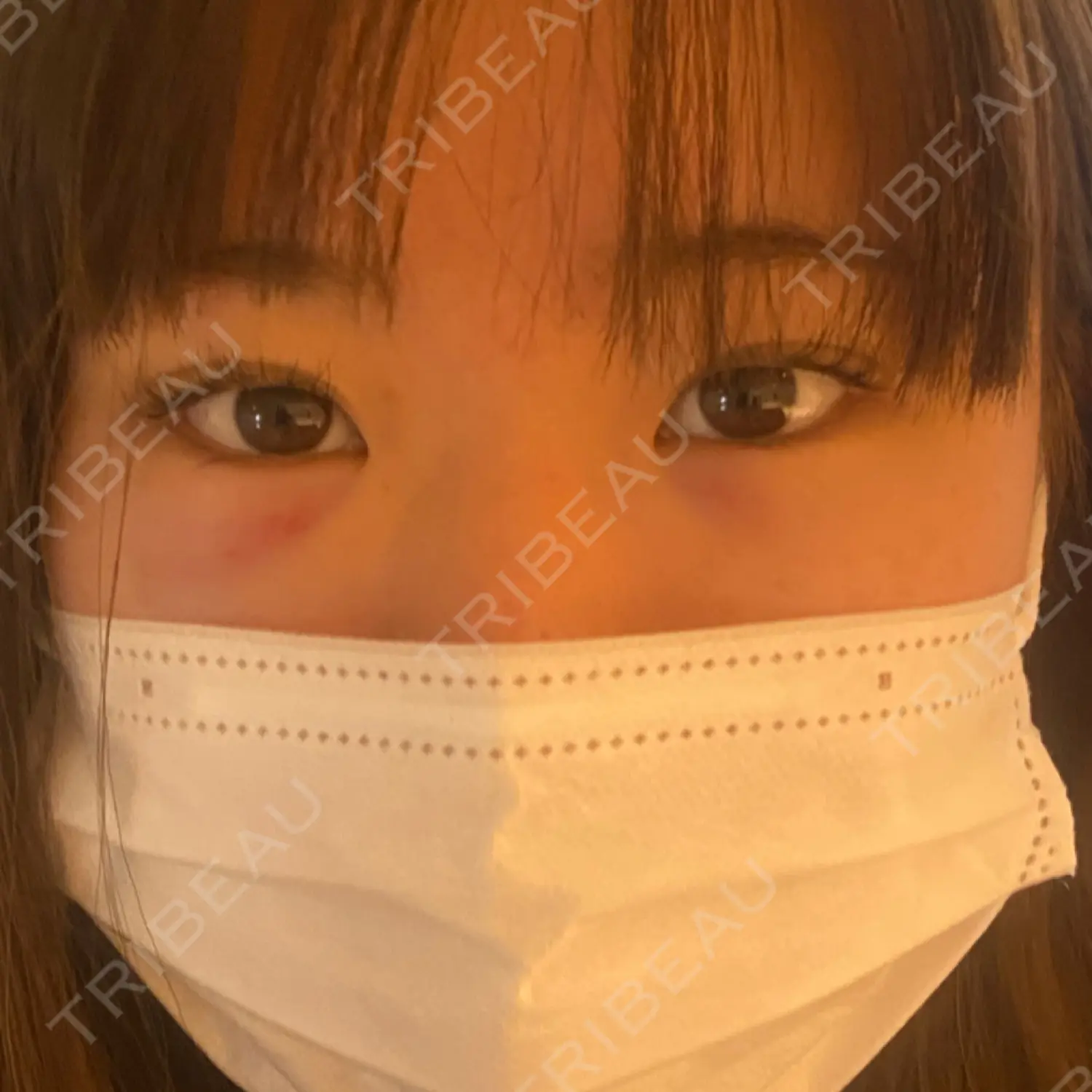 施術前の写真