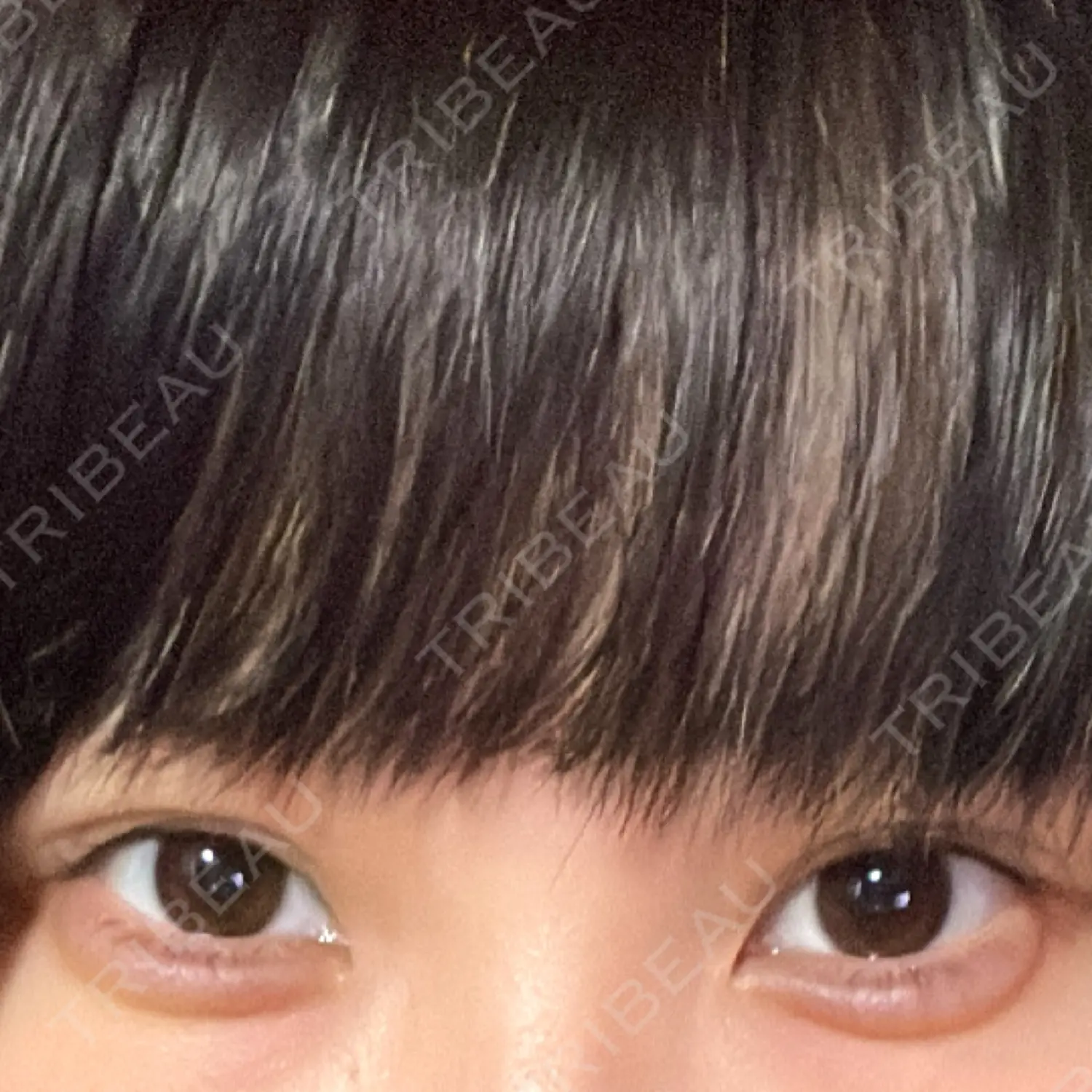施術前の写真