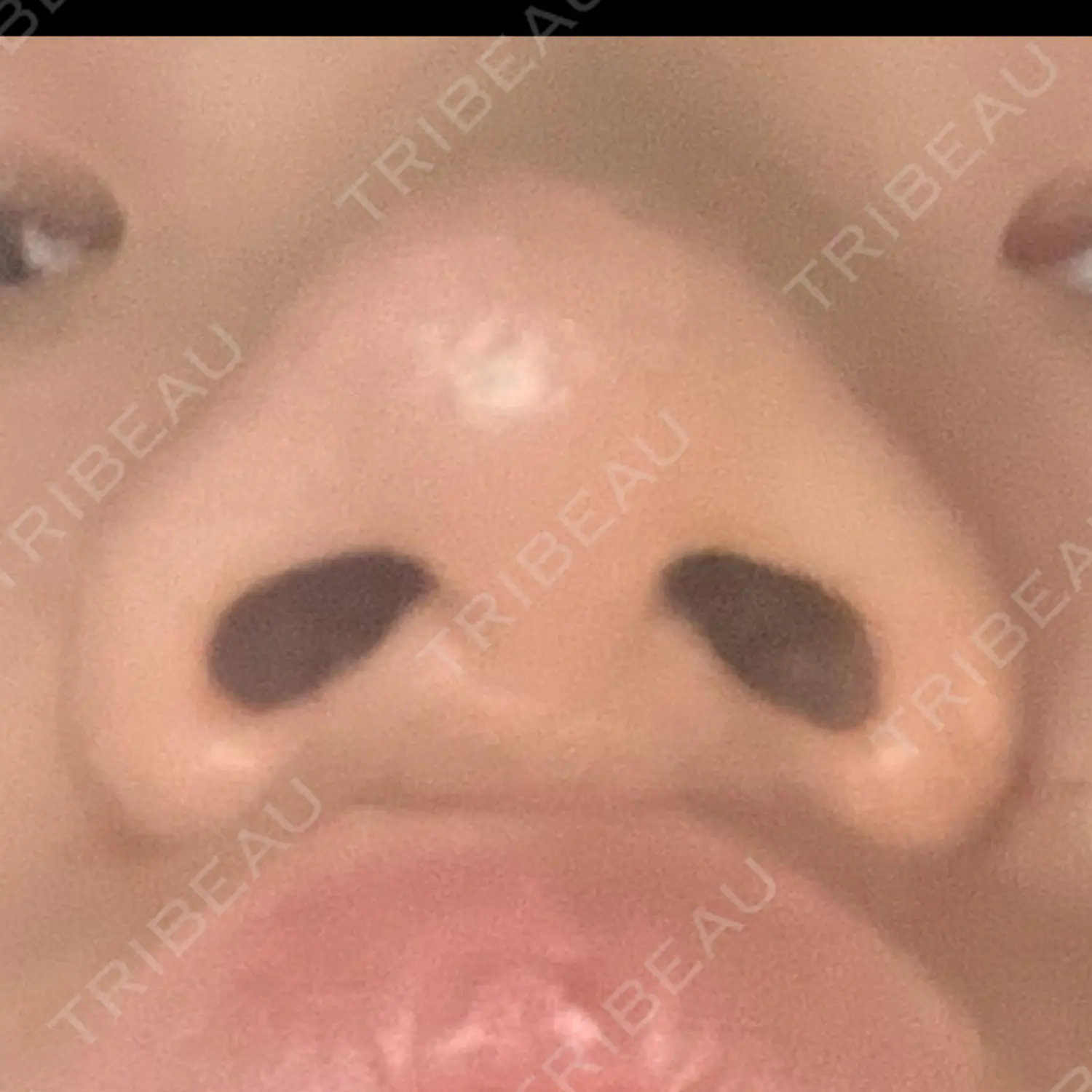 施術前の写真