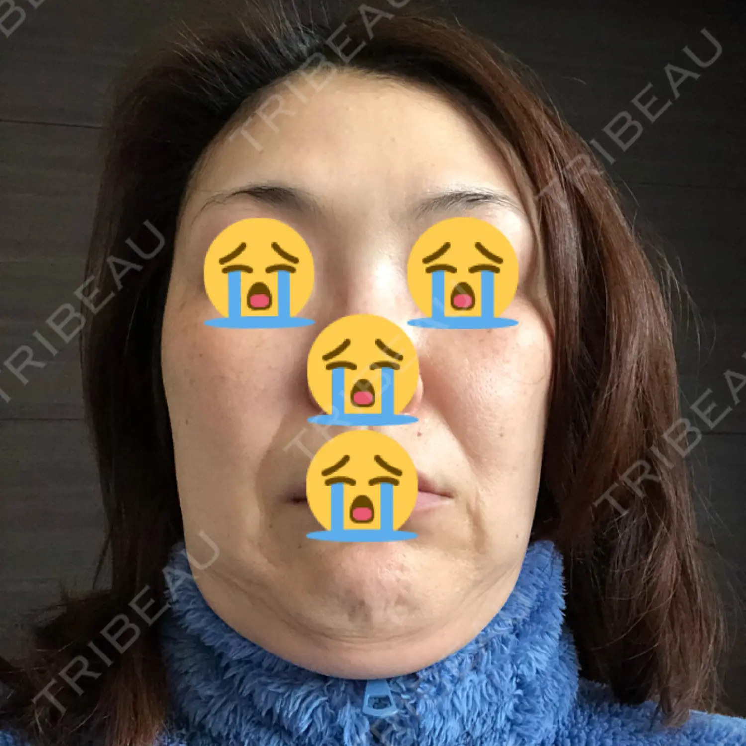 施術前の写真