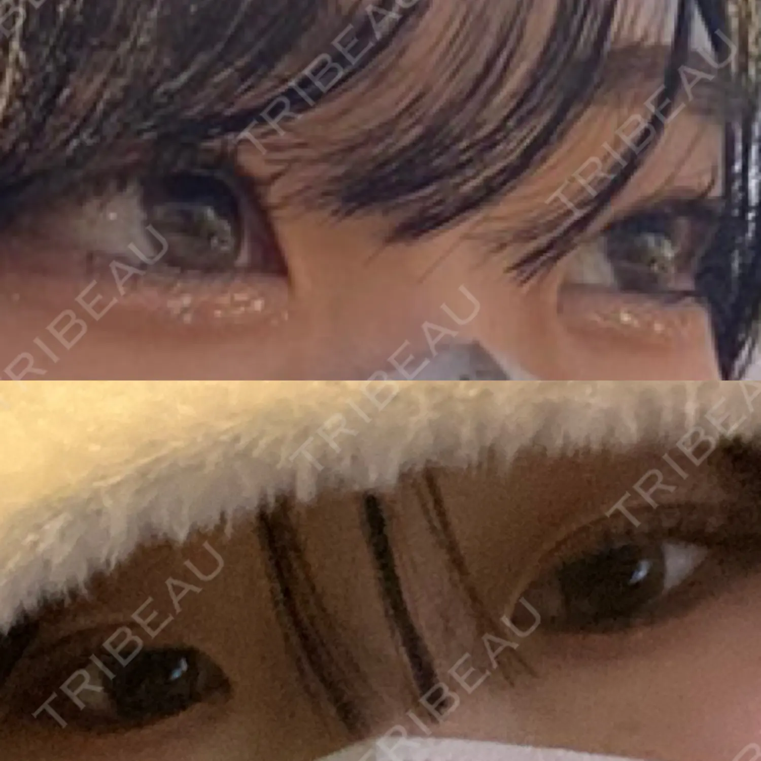 施術前の写真
