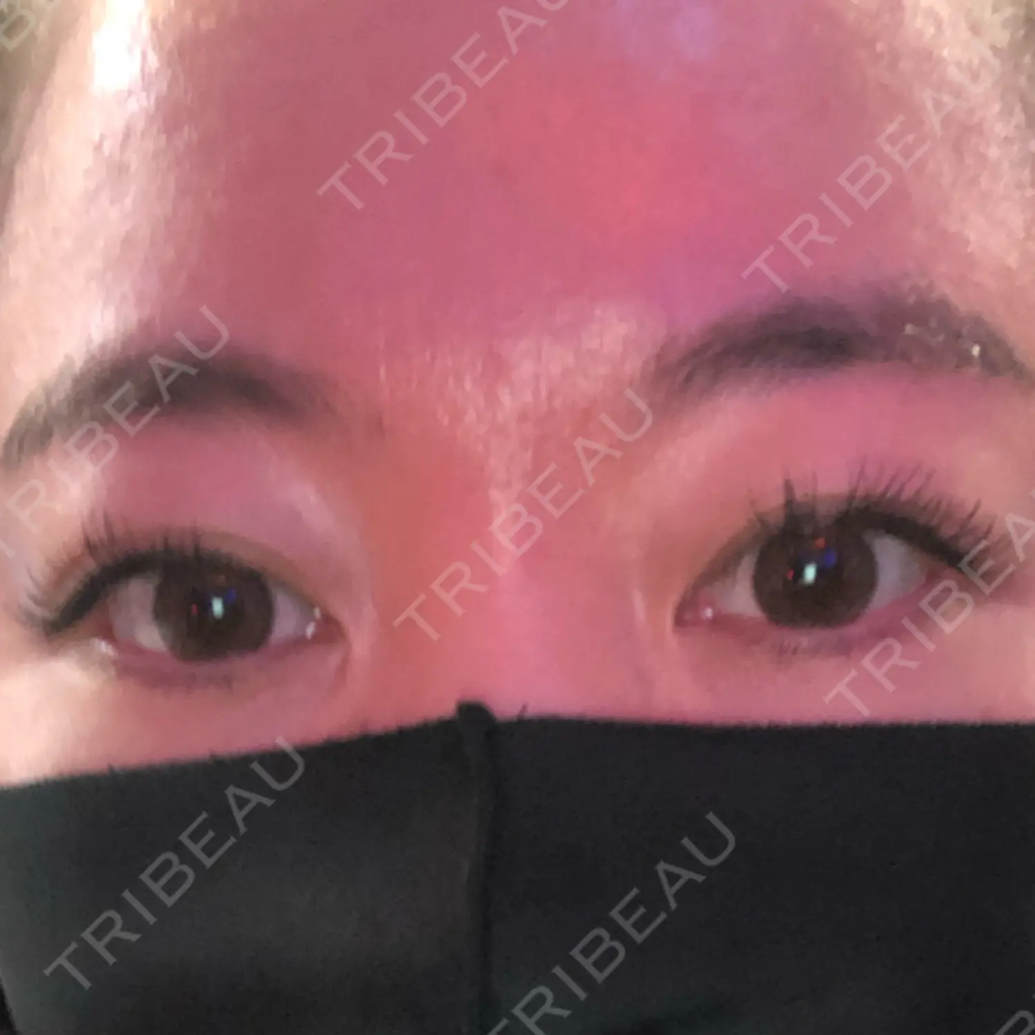 施術前の写真