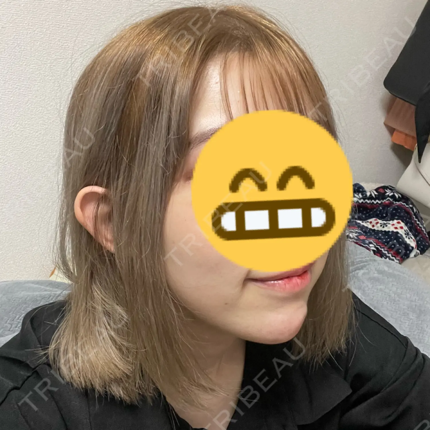 施術前の写真