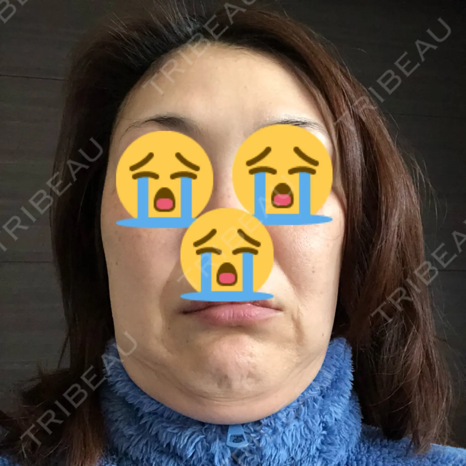 施術前の写真