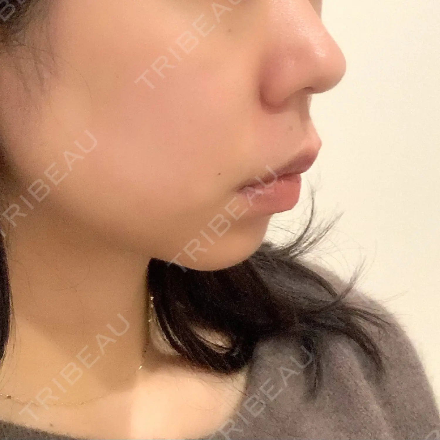 施術前の写真