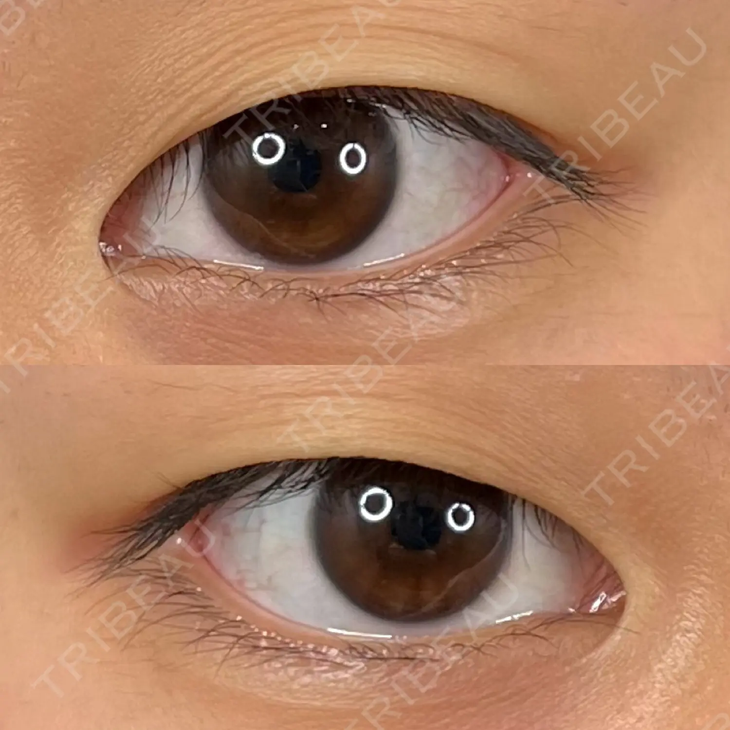 施術前の写真