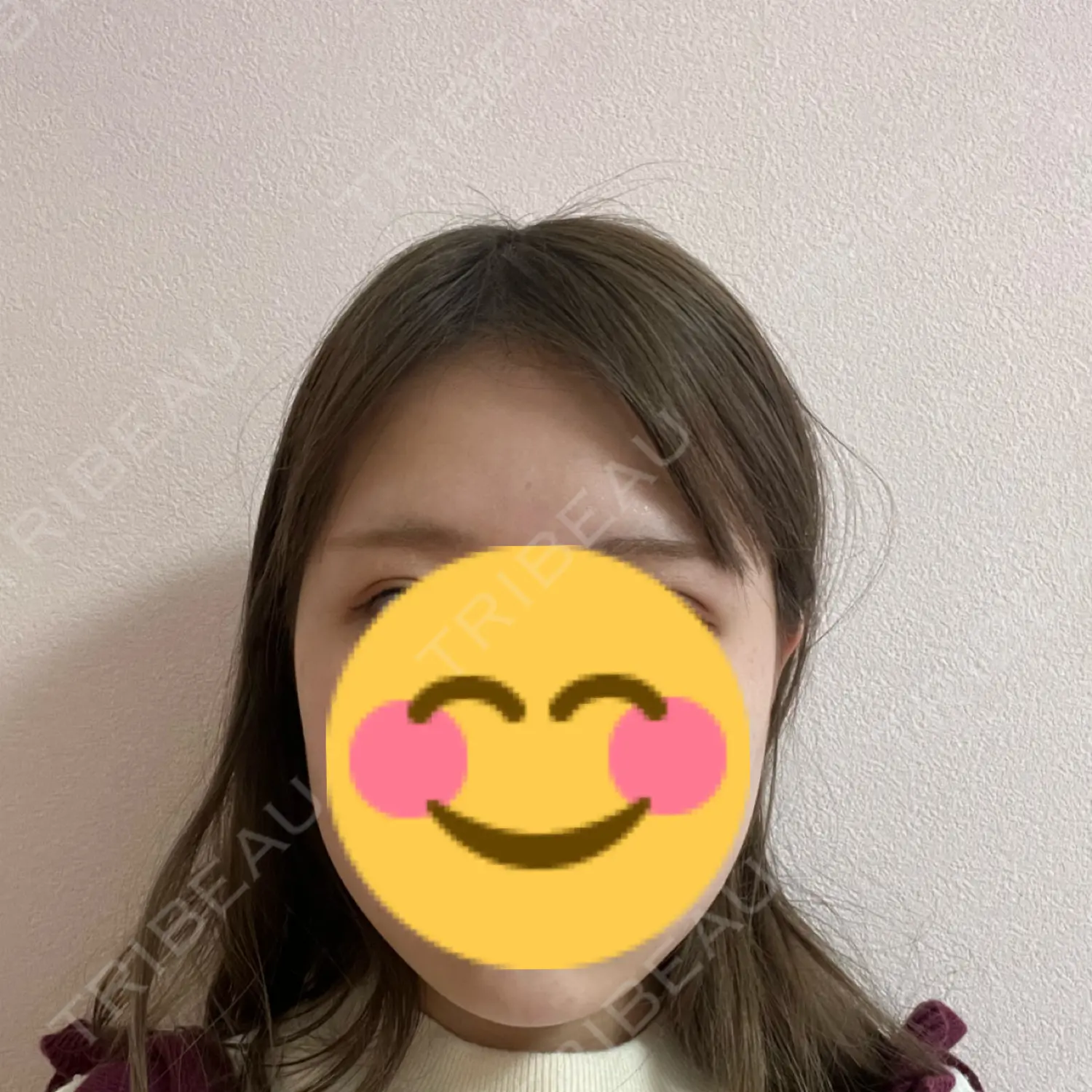 施術前の写真