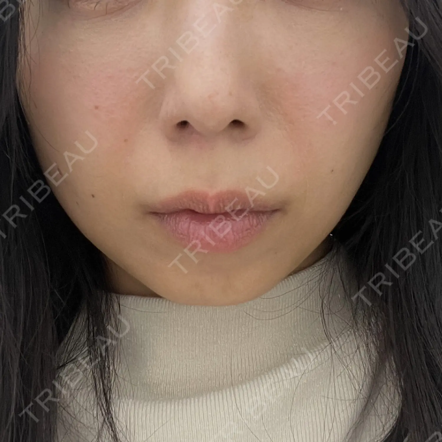 施術前の写真