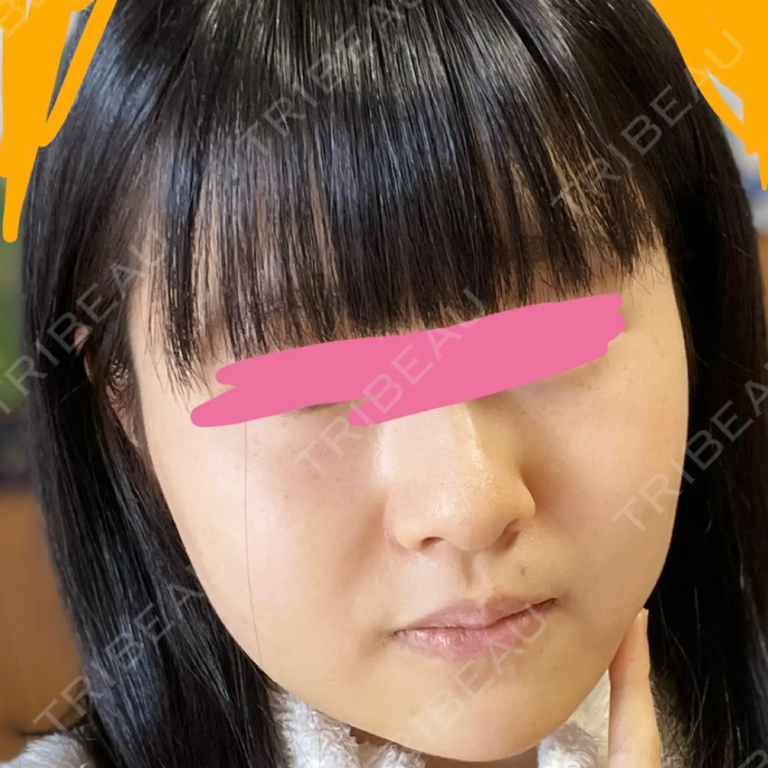 施術前の写真