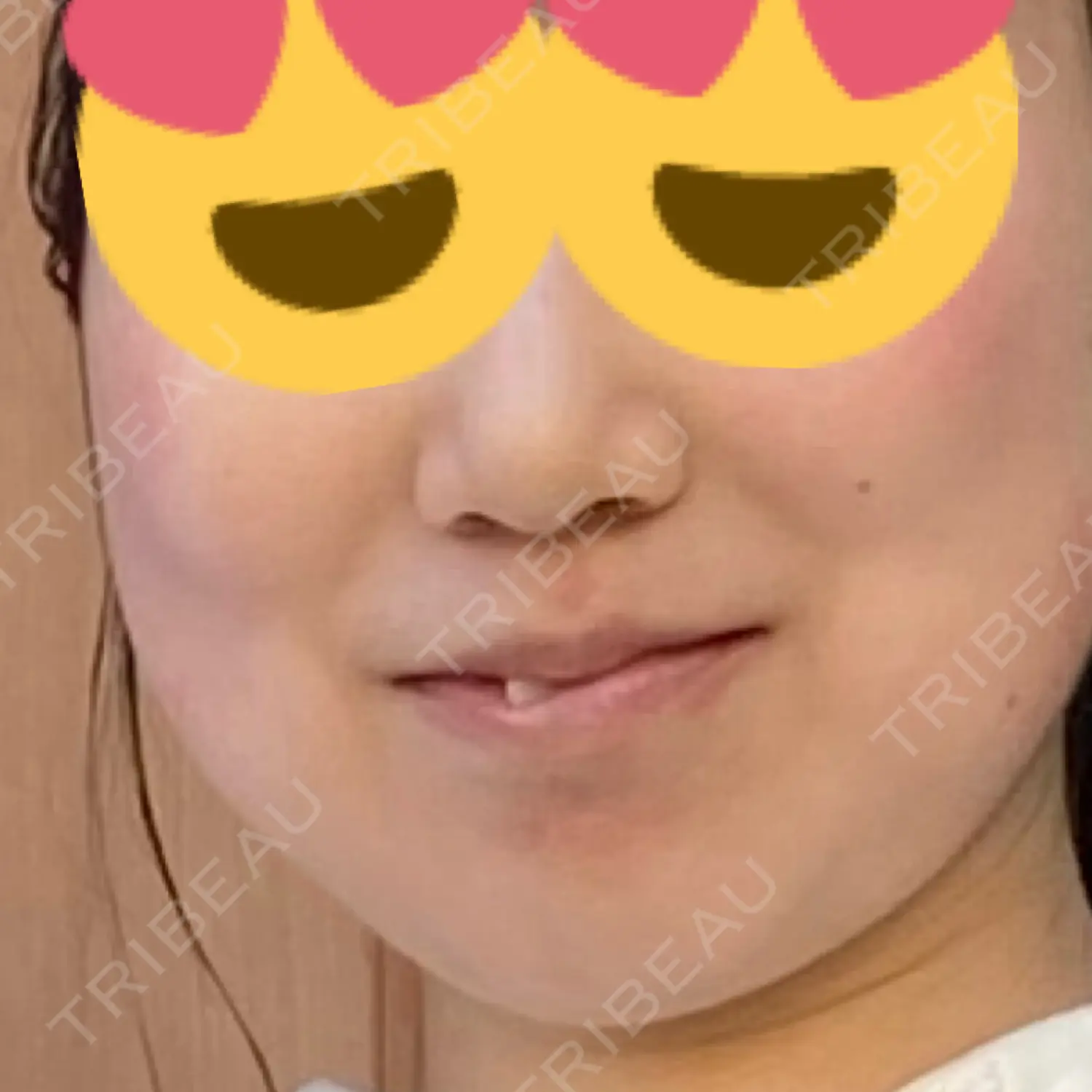 施術前の写真
