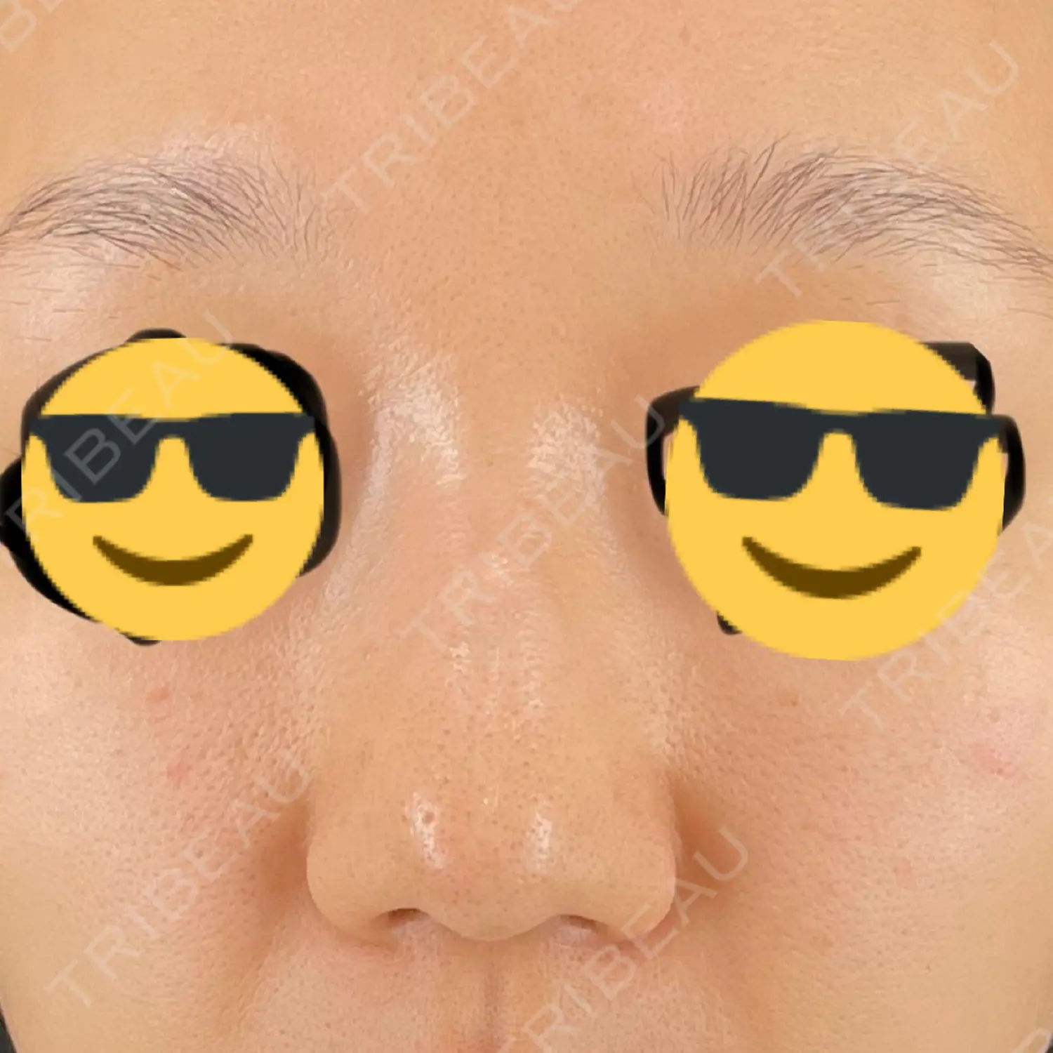 施術前の写真