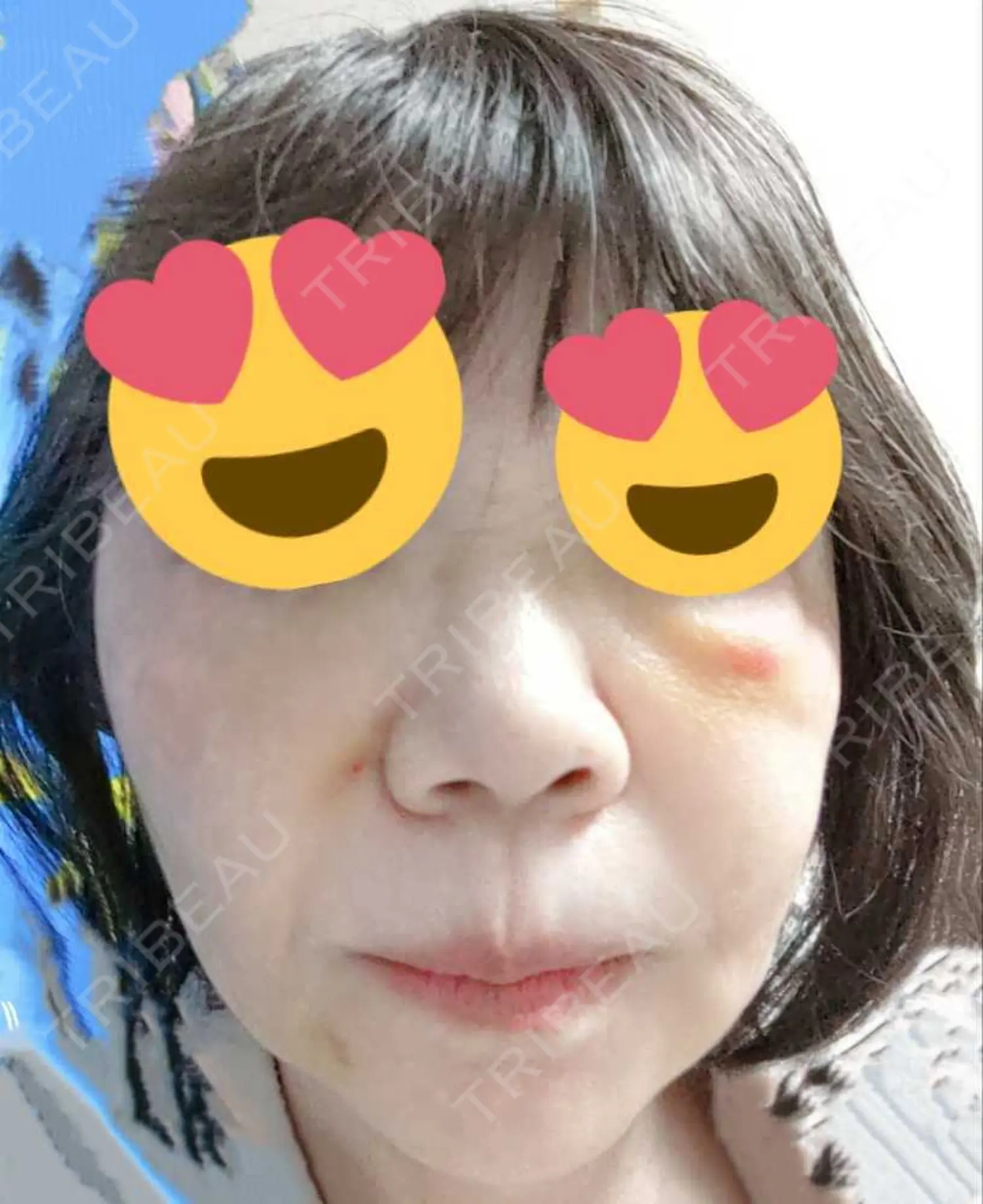 施術前の写真