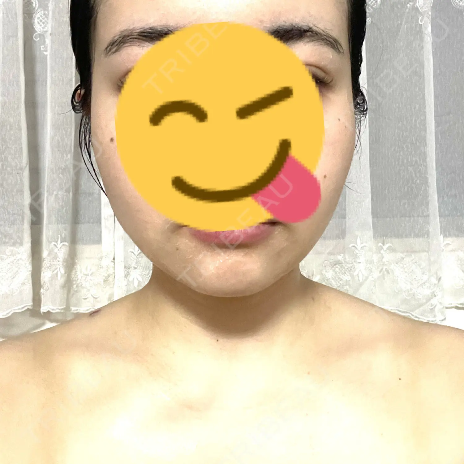 施術前の写真